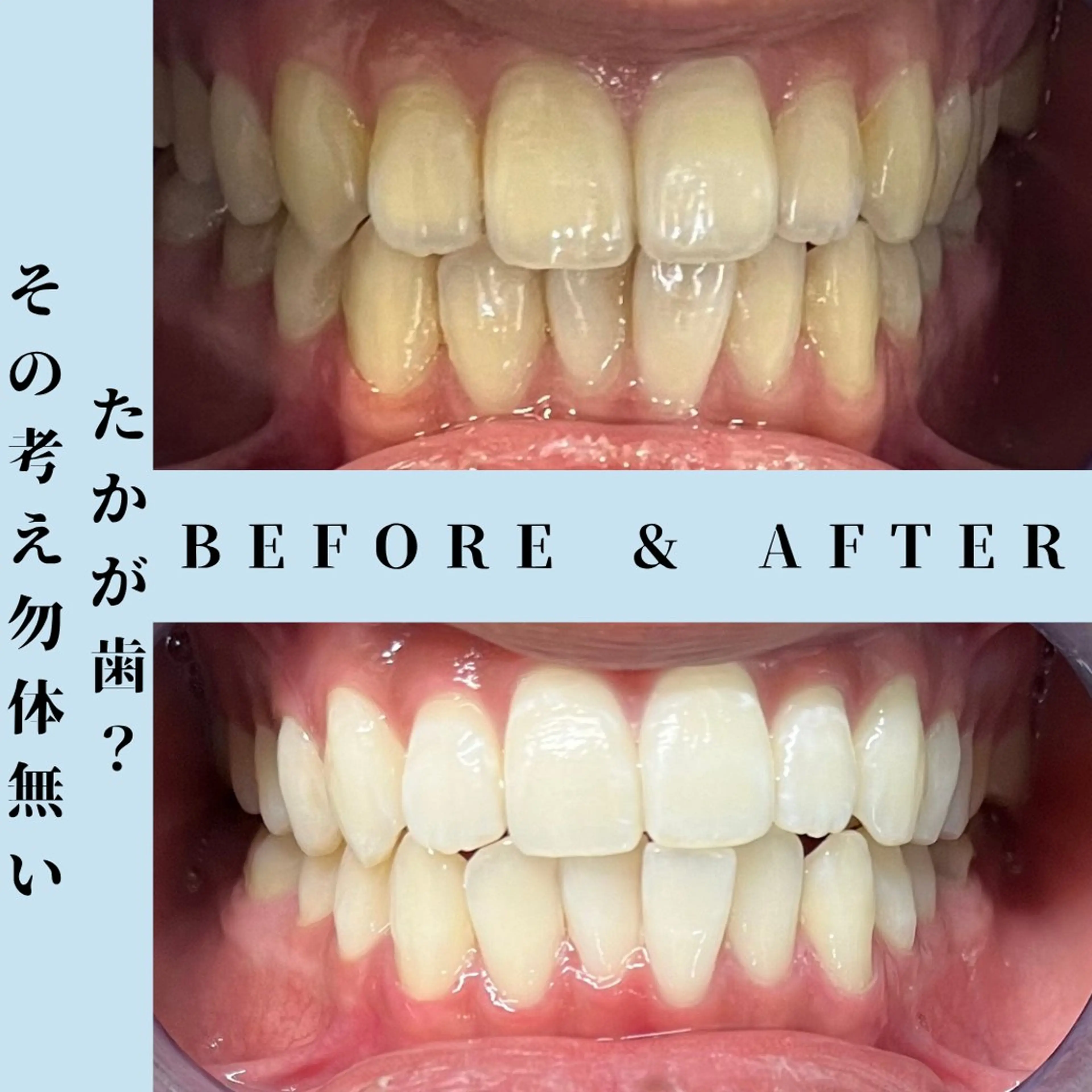 メンズ その他 セルフホワイトニング Dolce水戸店のその他イメージ