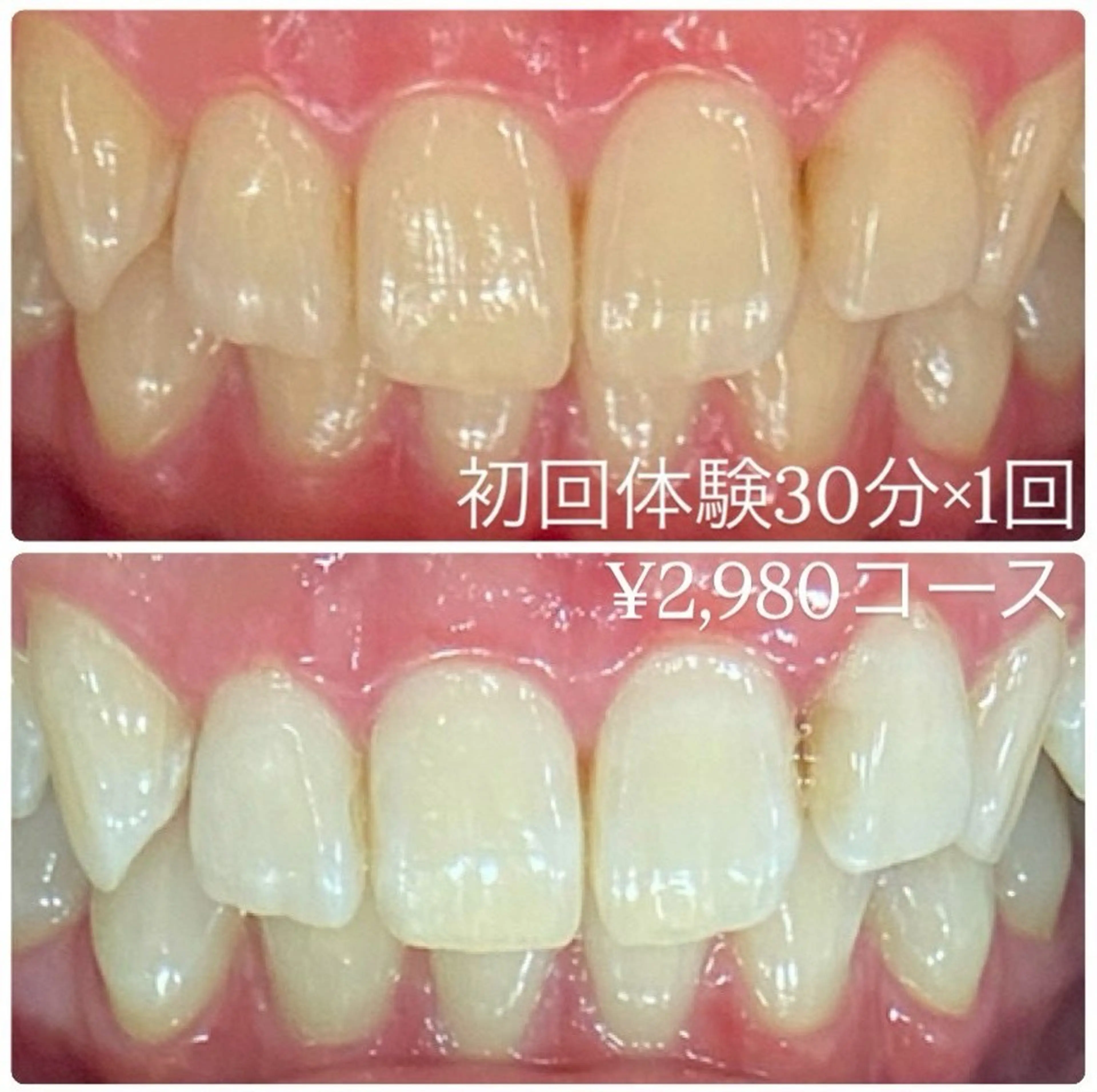 メンズ その他 ホワイトニングルーム 川崎店所属・ホワイトニング ルーム 川崎店のその他イメージ