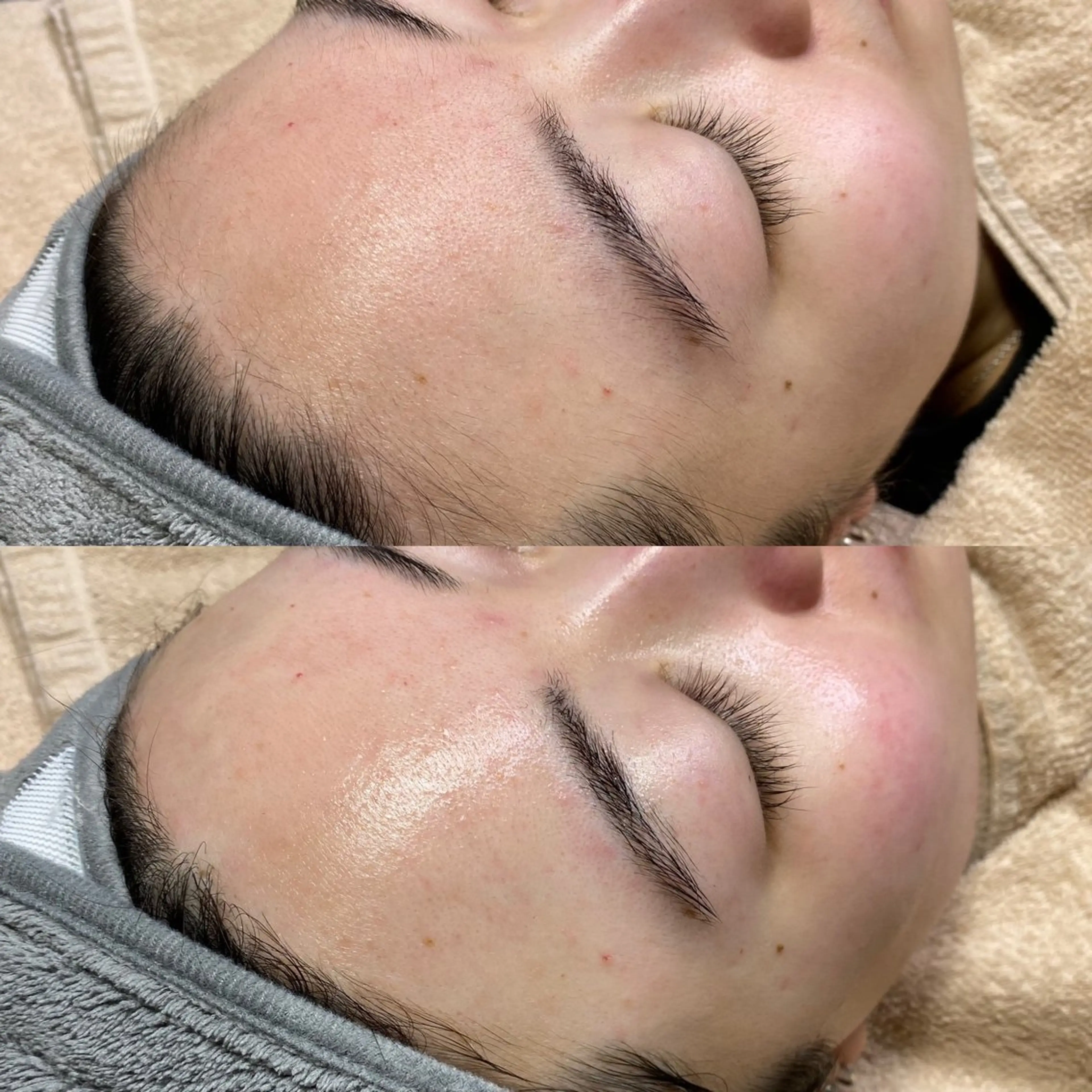 脱毛 脱毛サロンBloom所属・脱毛屋さん/池袋 /Bloom🍋わだのエステ・リラクイメージ