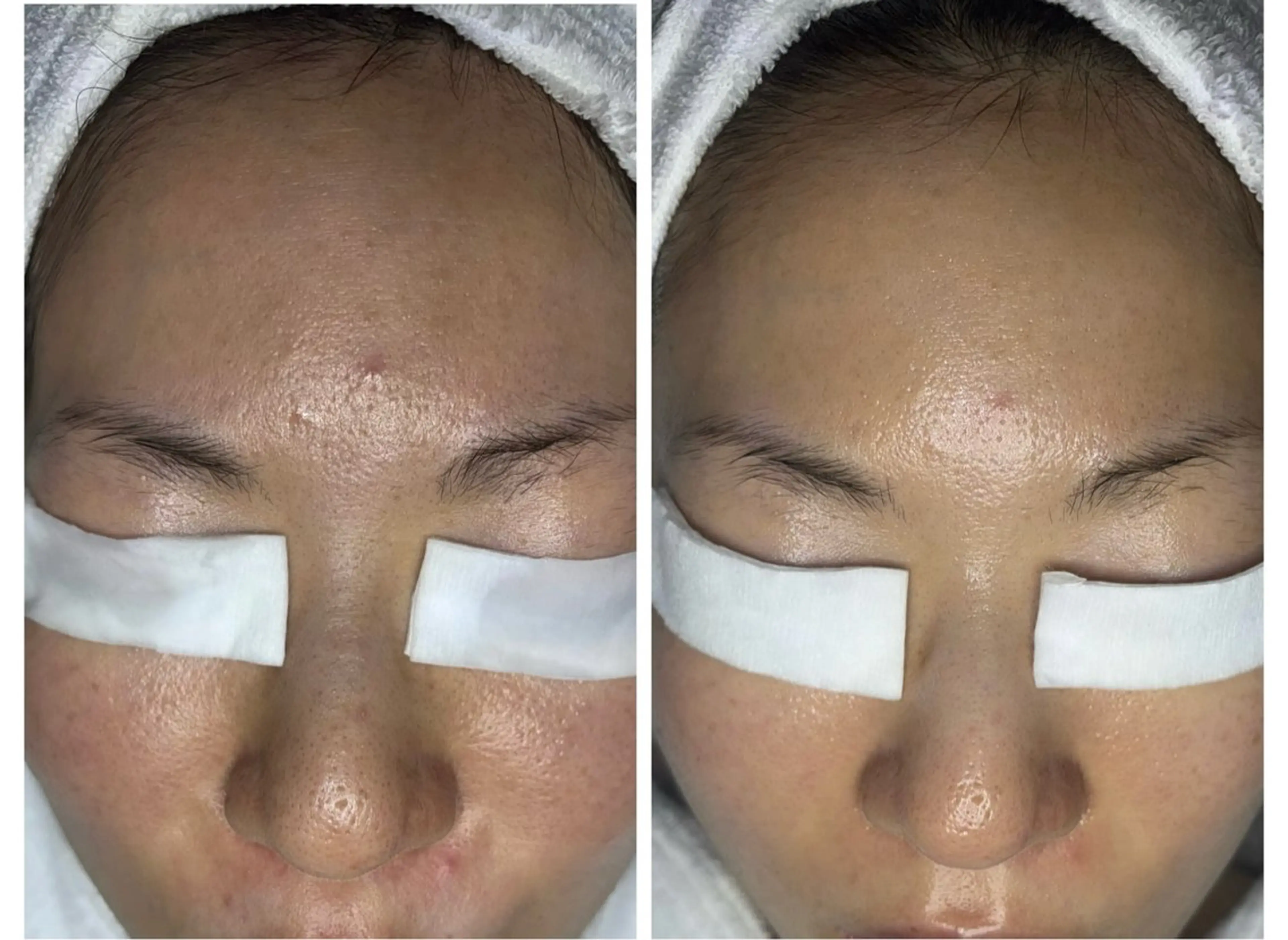 エステ リラク 肌改善・リンパサロン CoCoxiaのエステ・リラクイメージ