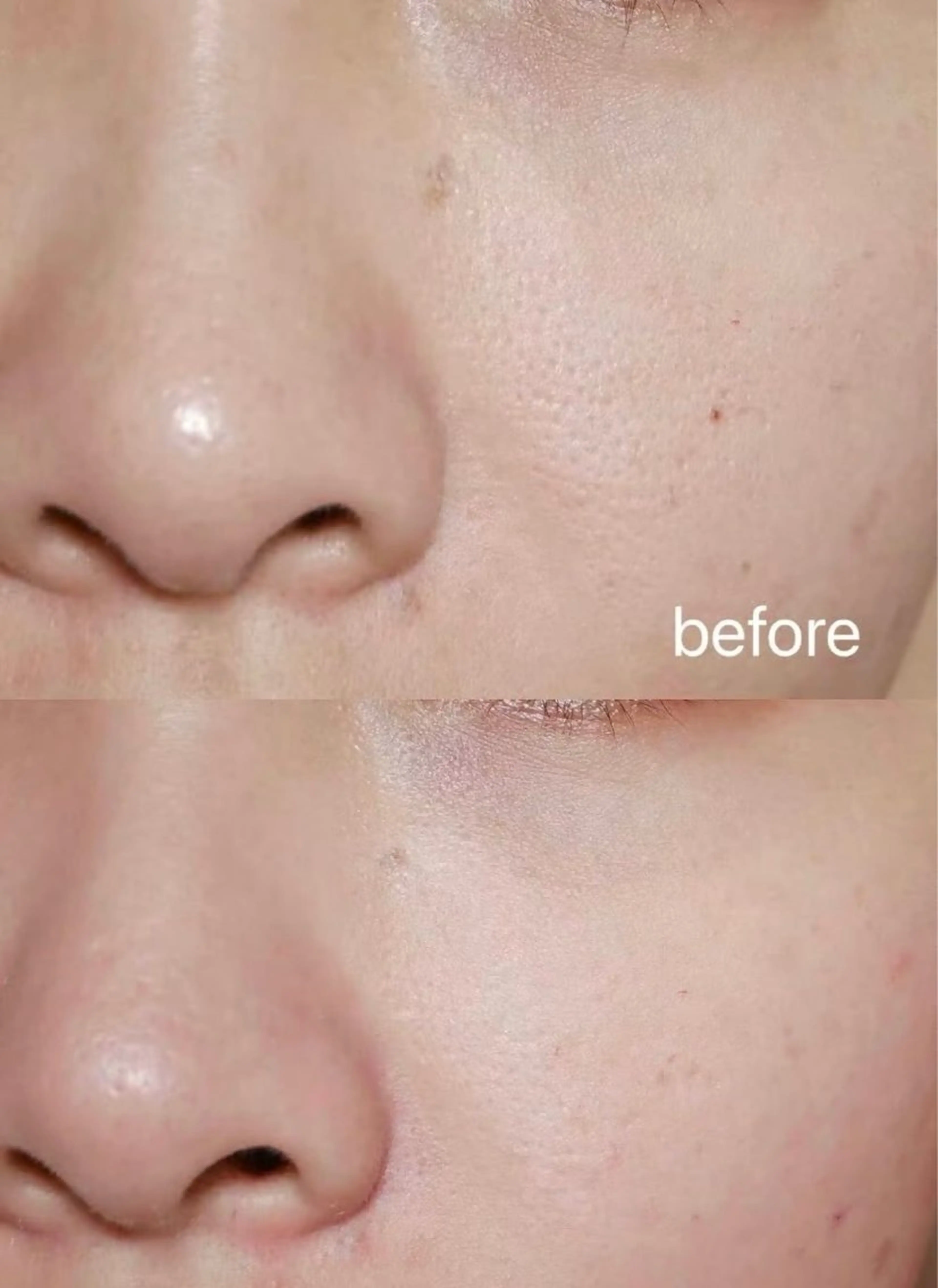 ネイル エステ aliaハイフ&水光ジェットサロン所属・aliaハーブ水光店 エステティシャン募集のエステ・リラクイメージ