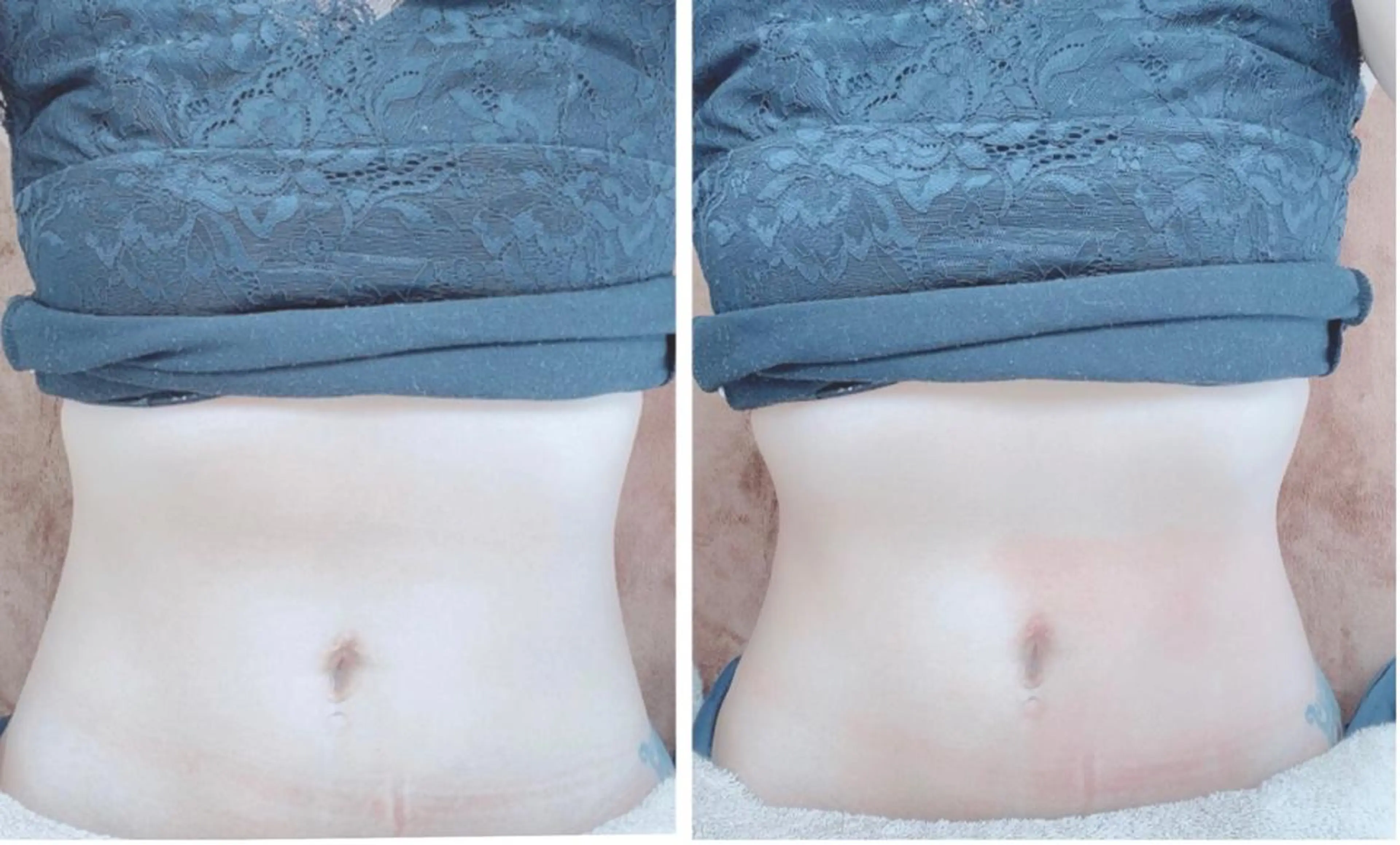 プライベートサロン Lｏｋａｈｉ飯生透のエステ・リラクイメージ