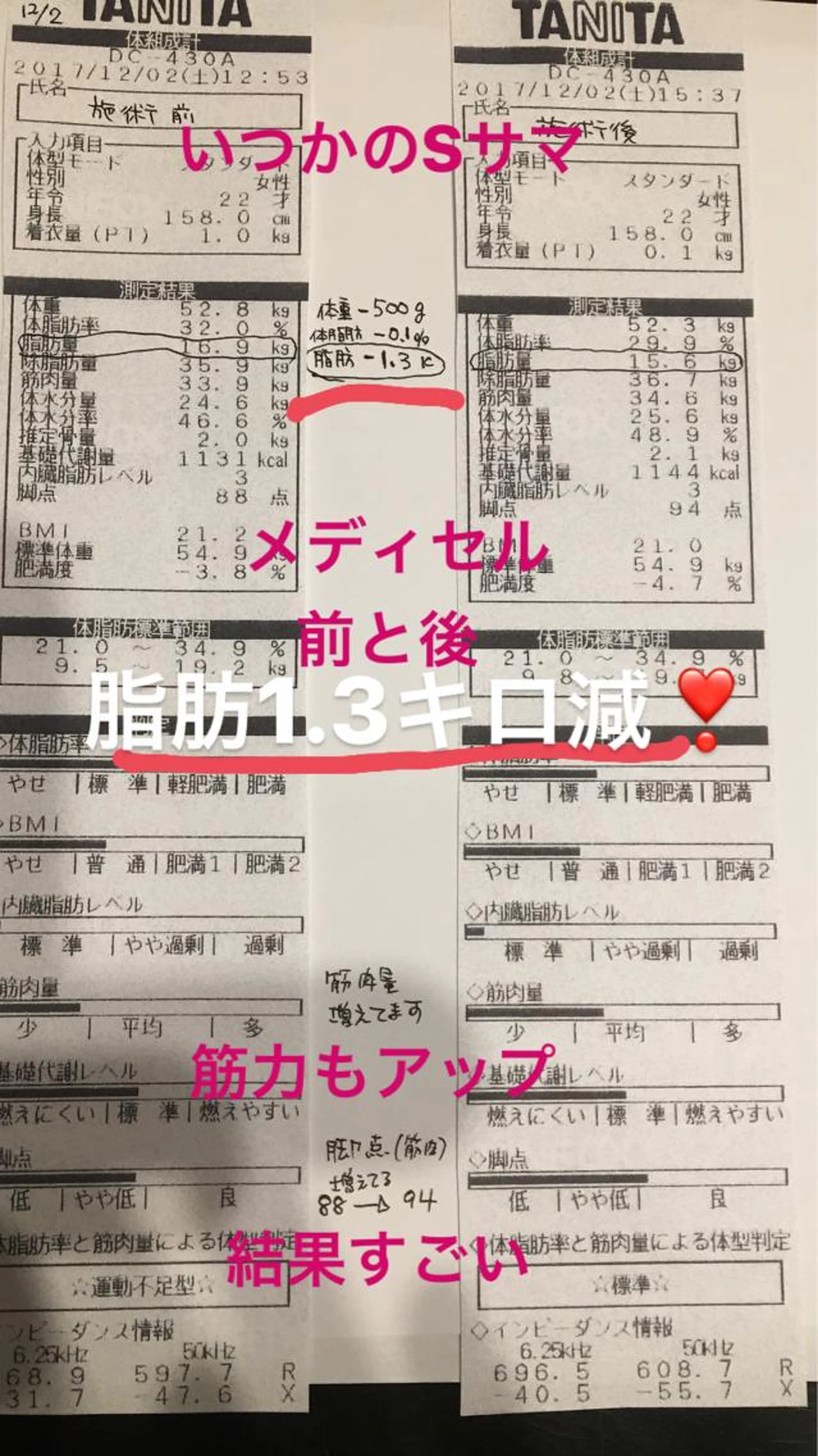 ［新規様限定］引き締めメディセル半身(30分)二回付.耳つぼ一回付キャンペーン！の写真