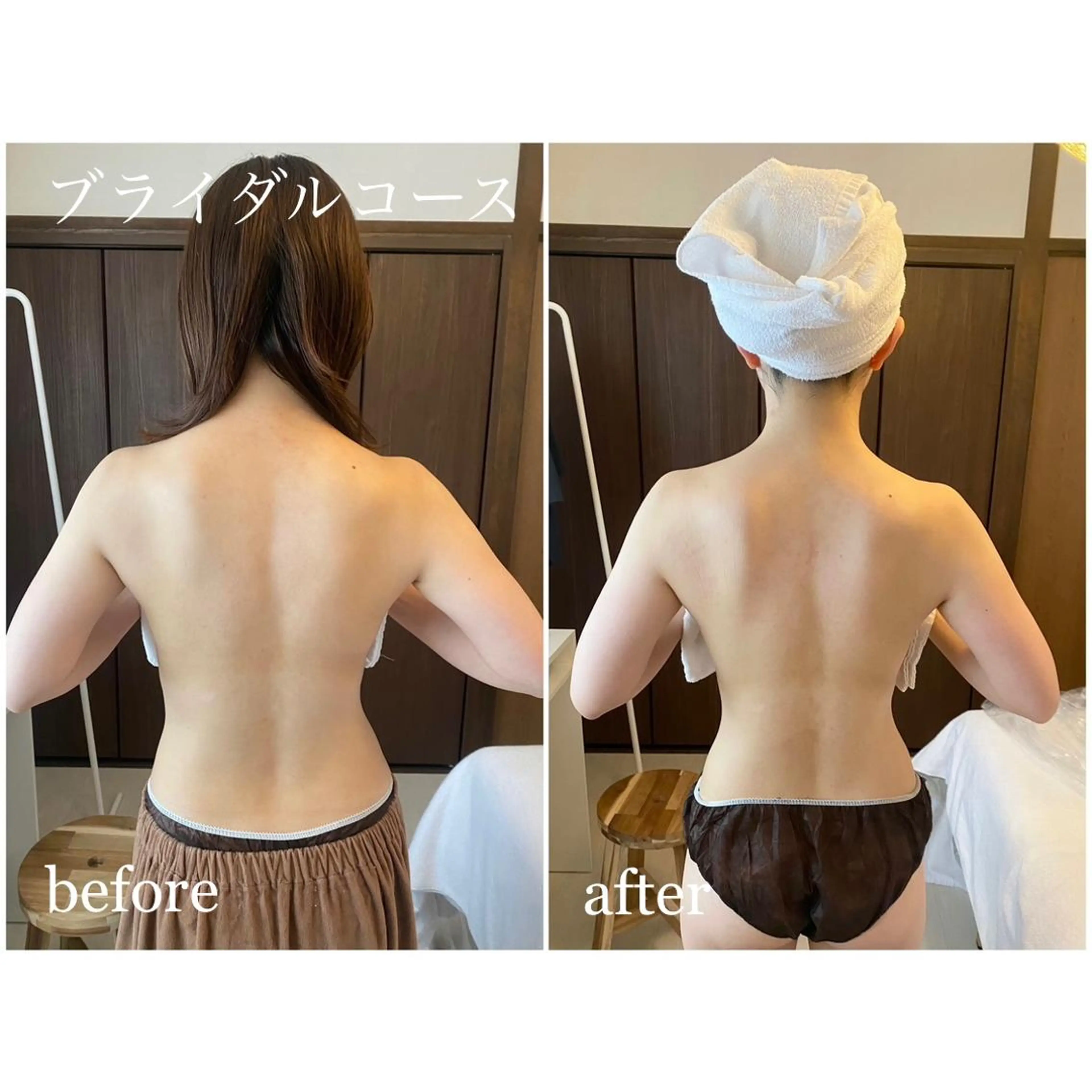 I'm -ｲﾑ-所属・肌質改善／ブライダル I'm.-イム-のエステ・リラクイメージ