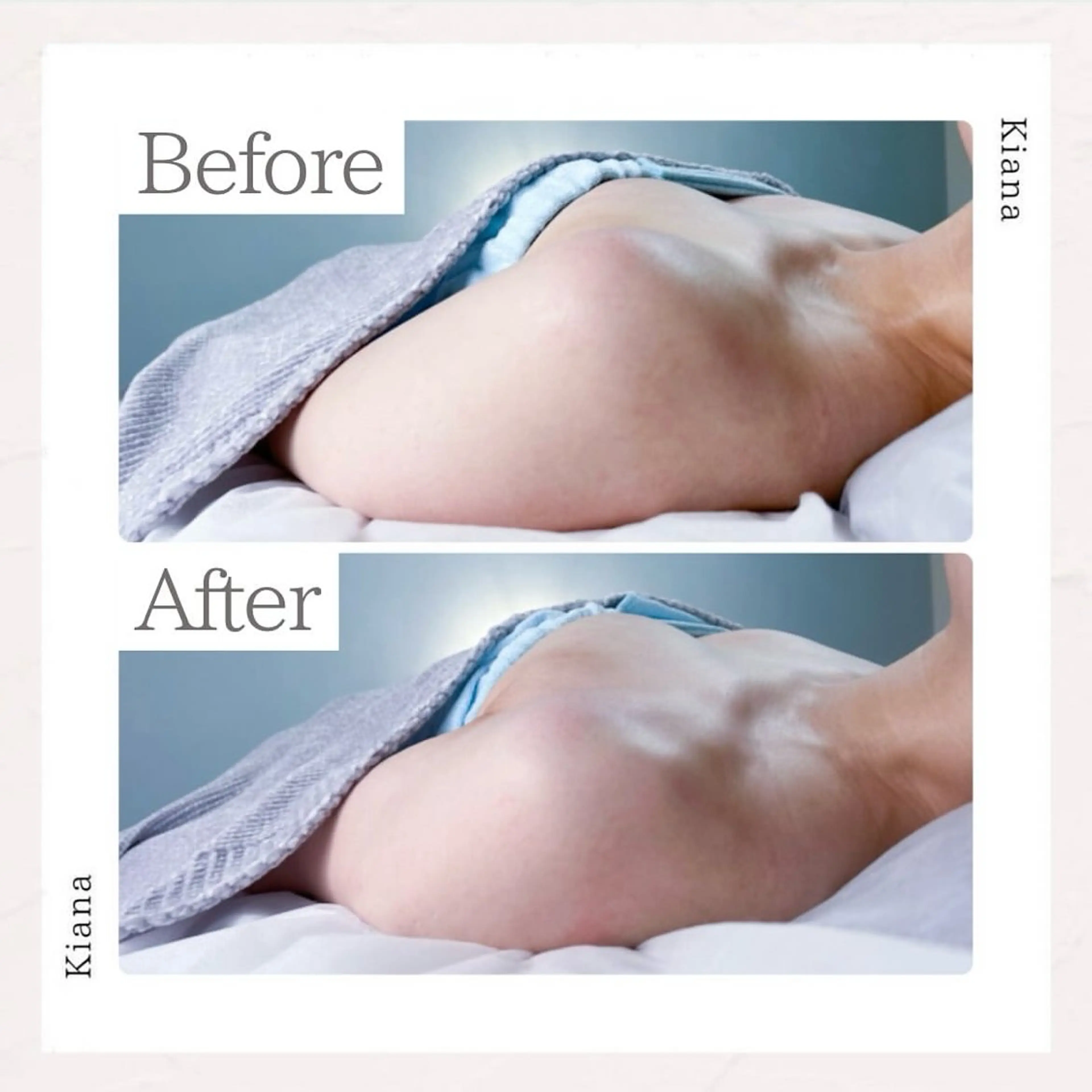 エステ リラク バスト専門Kiana 風のエステ・リラクイメージ