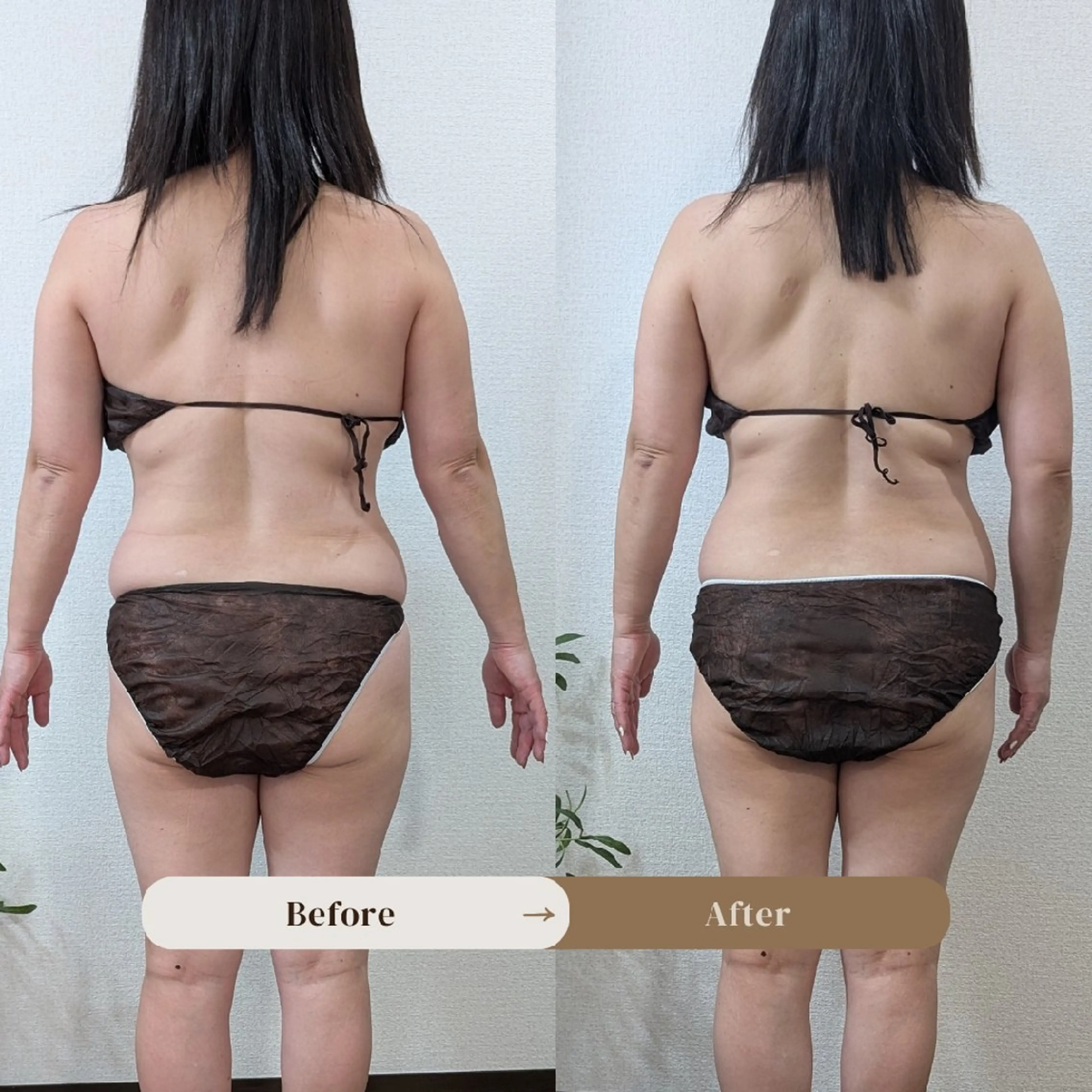 【痩身▪️体質改善ダイエット】美養サロンEnbi～縁美～所属・美養サロンEnbi ～縁美～のエステ・リラクイメージ