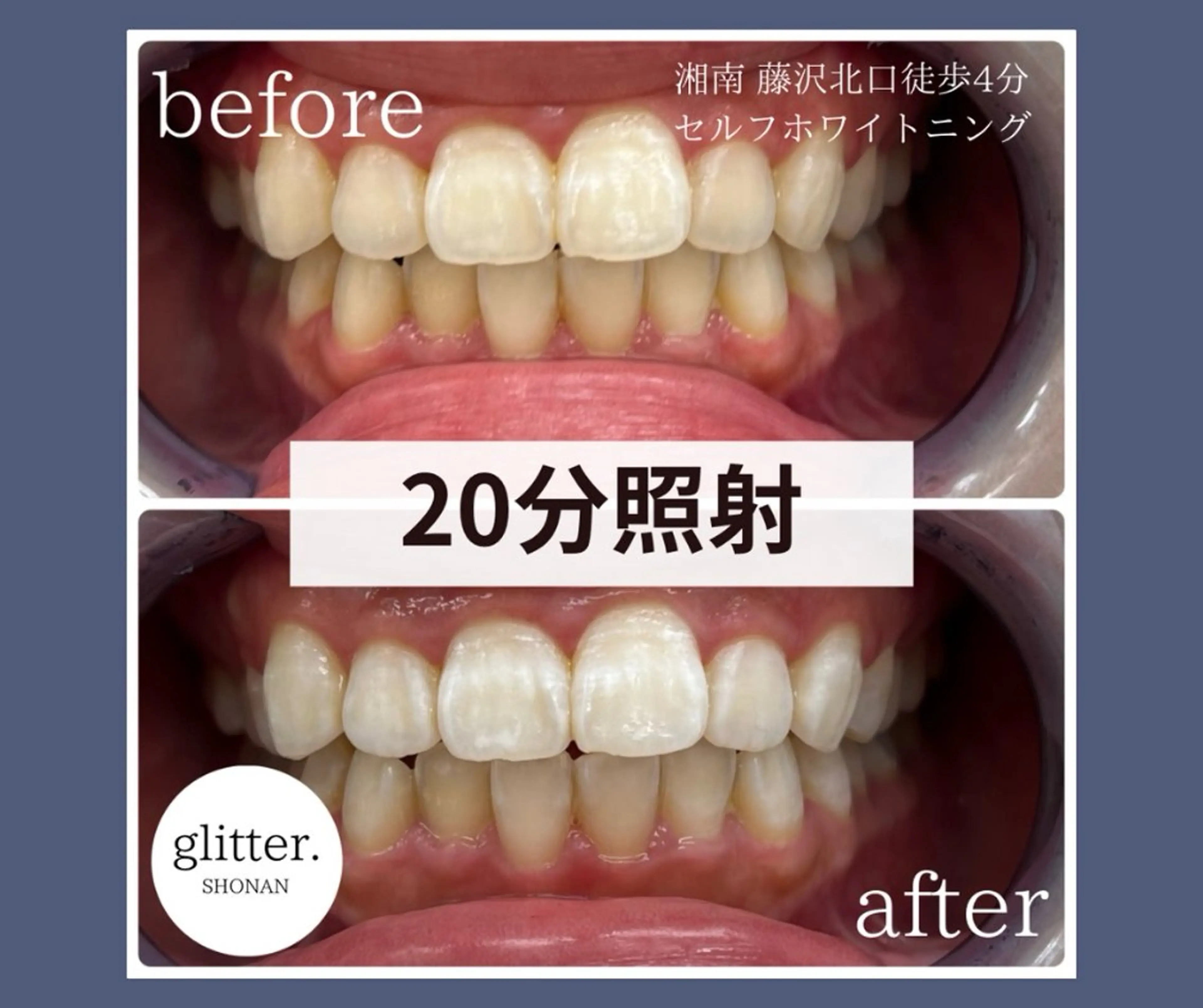 マツエク・マツパ glitter.SHONAN所属・ホワイトニング専門店 glitterのその他イメージ