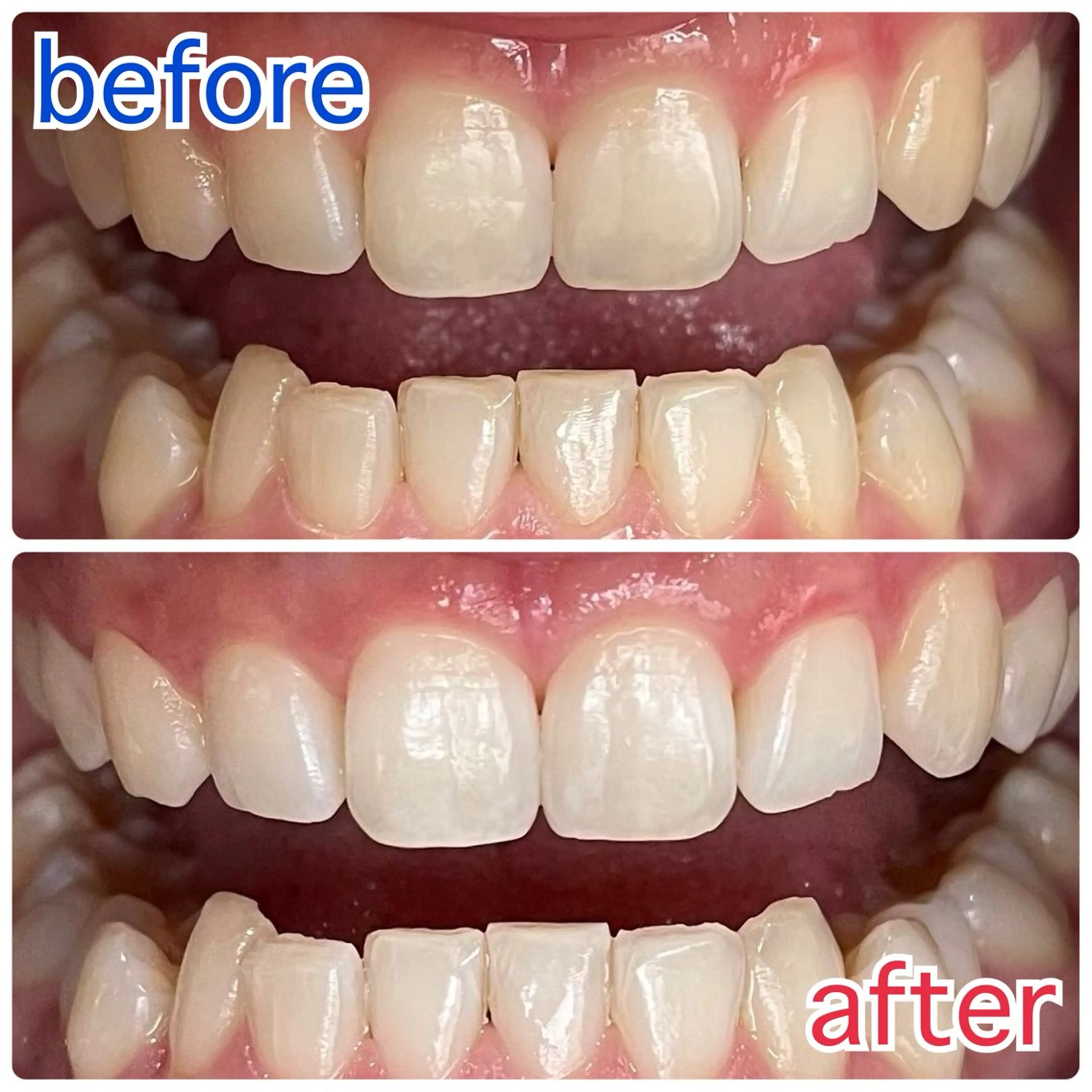 サクッとホワイト五反田店所属・セルフホワイトニング 五反田のその他イメージ