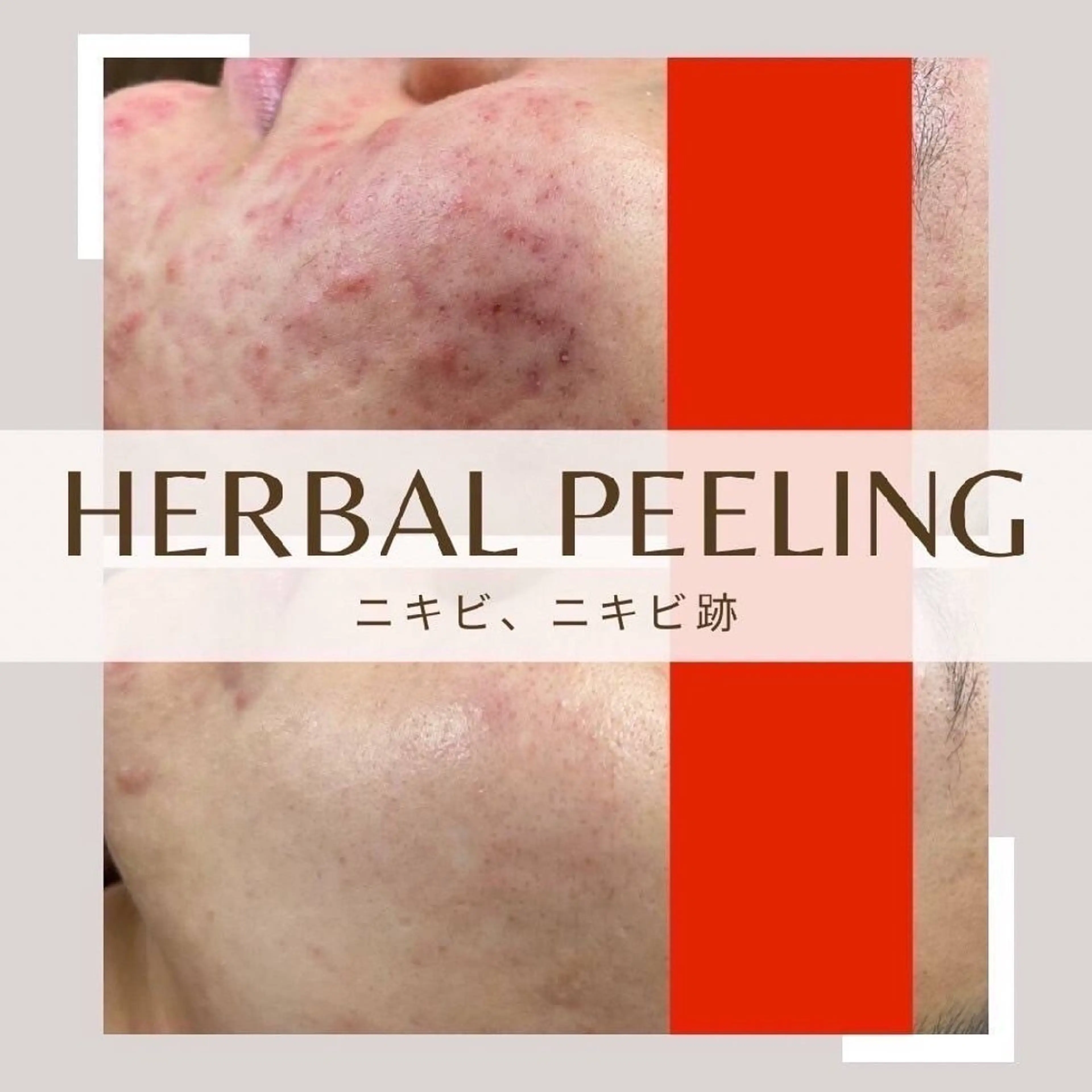 エステ アゲハビューティークリニック所属・アゲハビューティー クリニックのマツエク・マツパデザイン