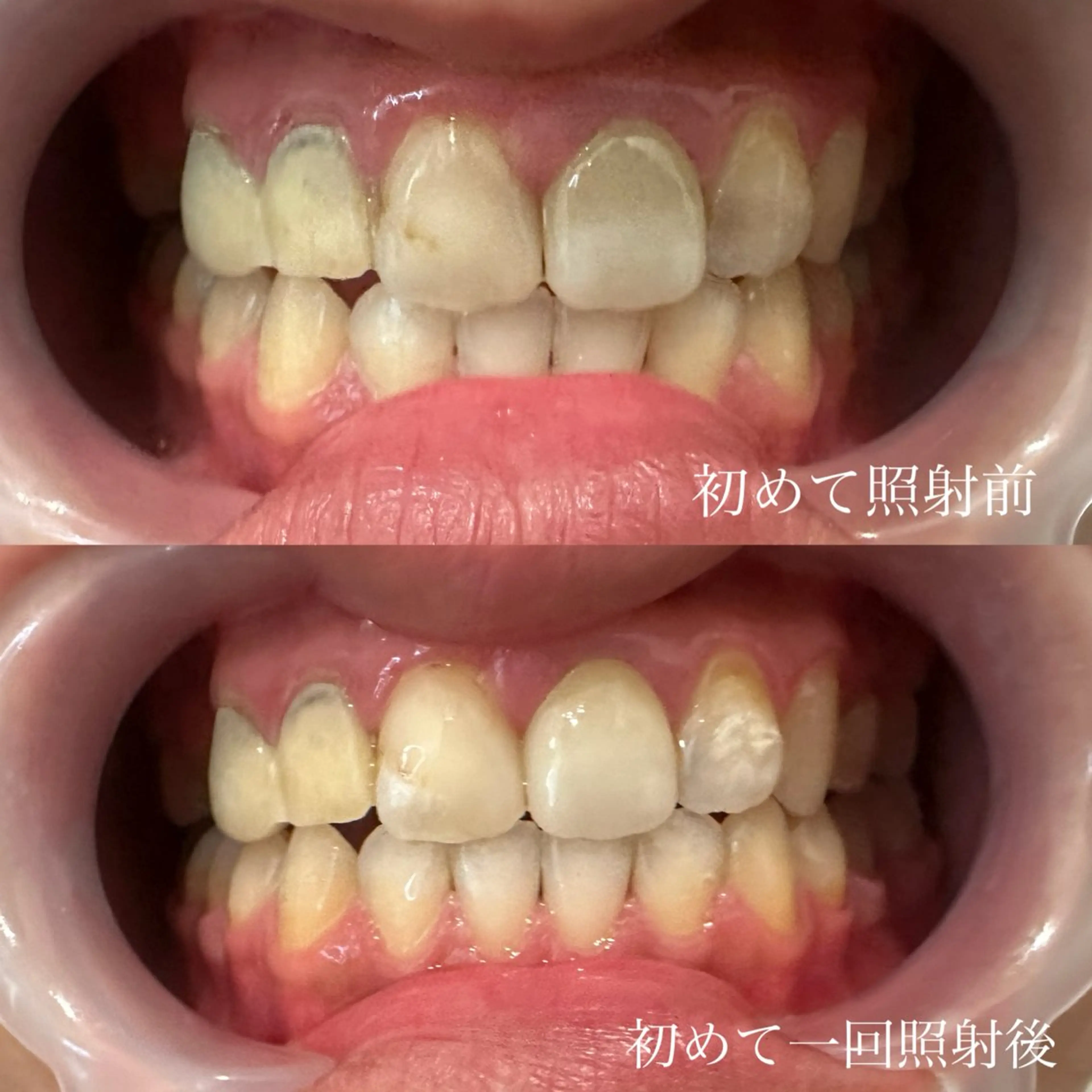 撮影モデル 𝐑𝐞𝐯𝐢𝐨 ___堺市西区のその他イメージ