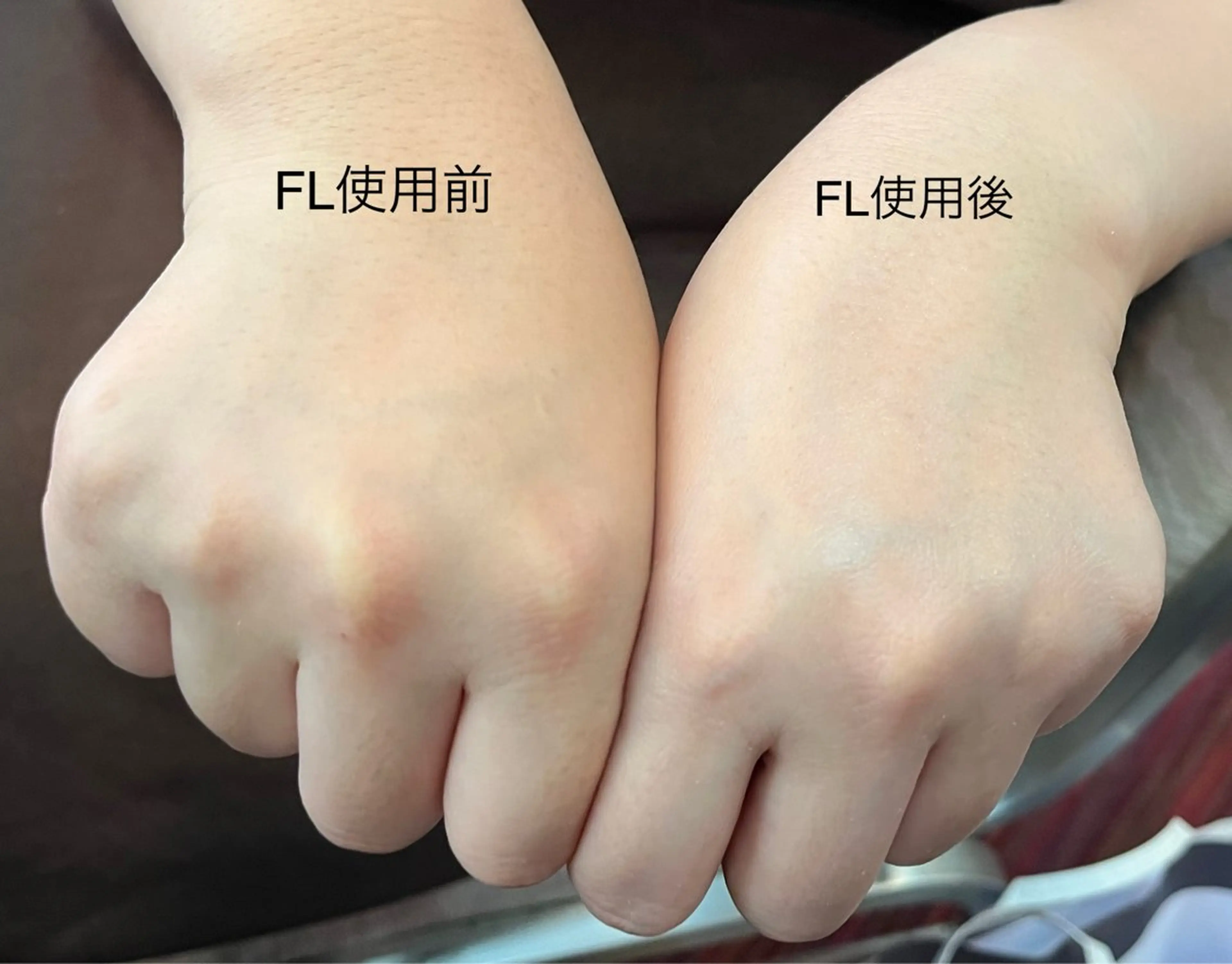 【無料】ビューティハンドケア👐の写真