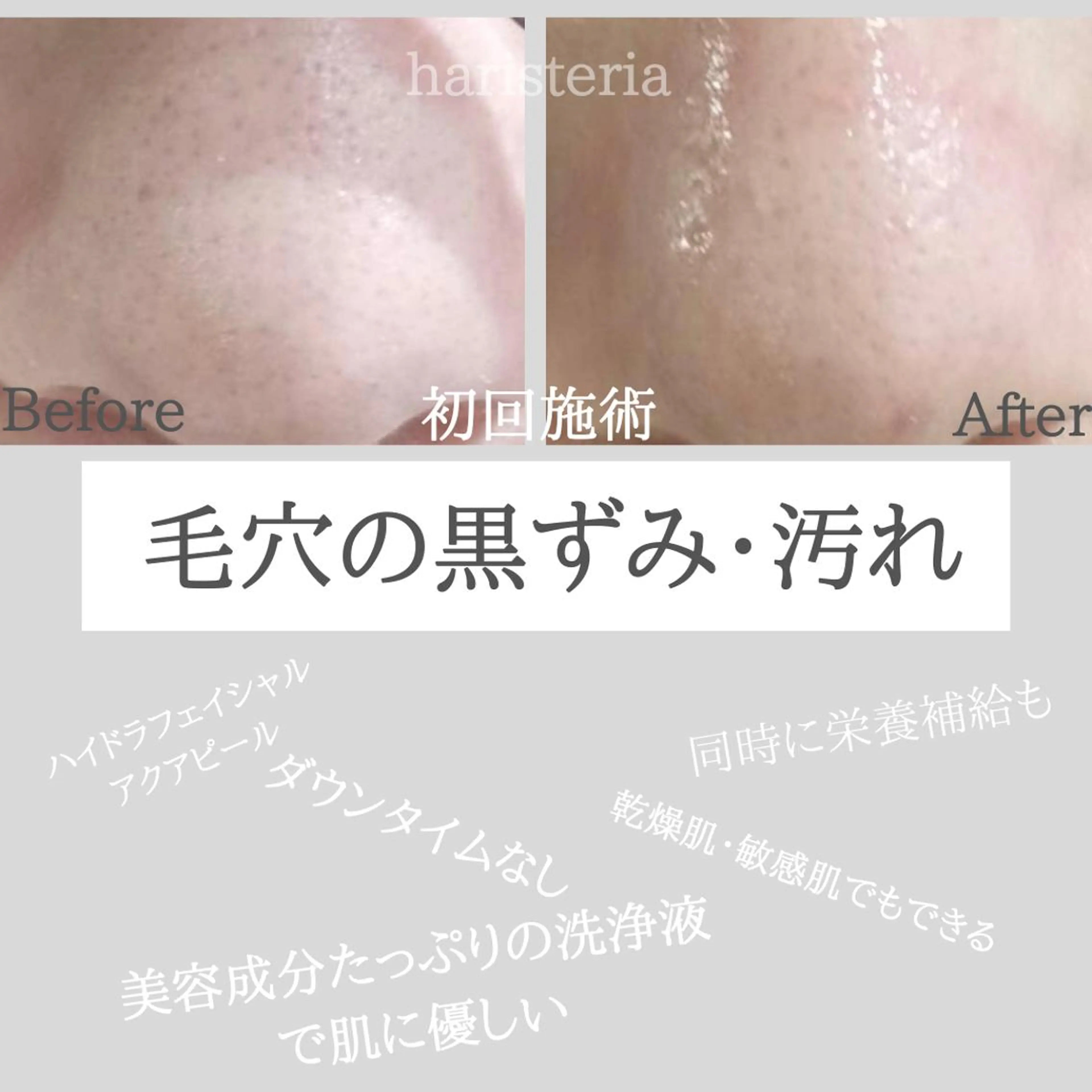 小顔・ツルツル素肌 ハリステリアのエステ・リラクイメージ