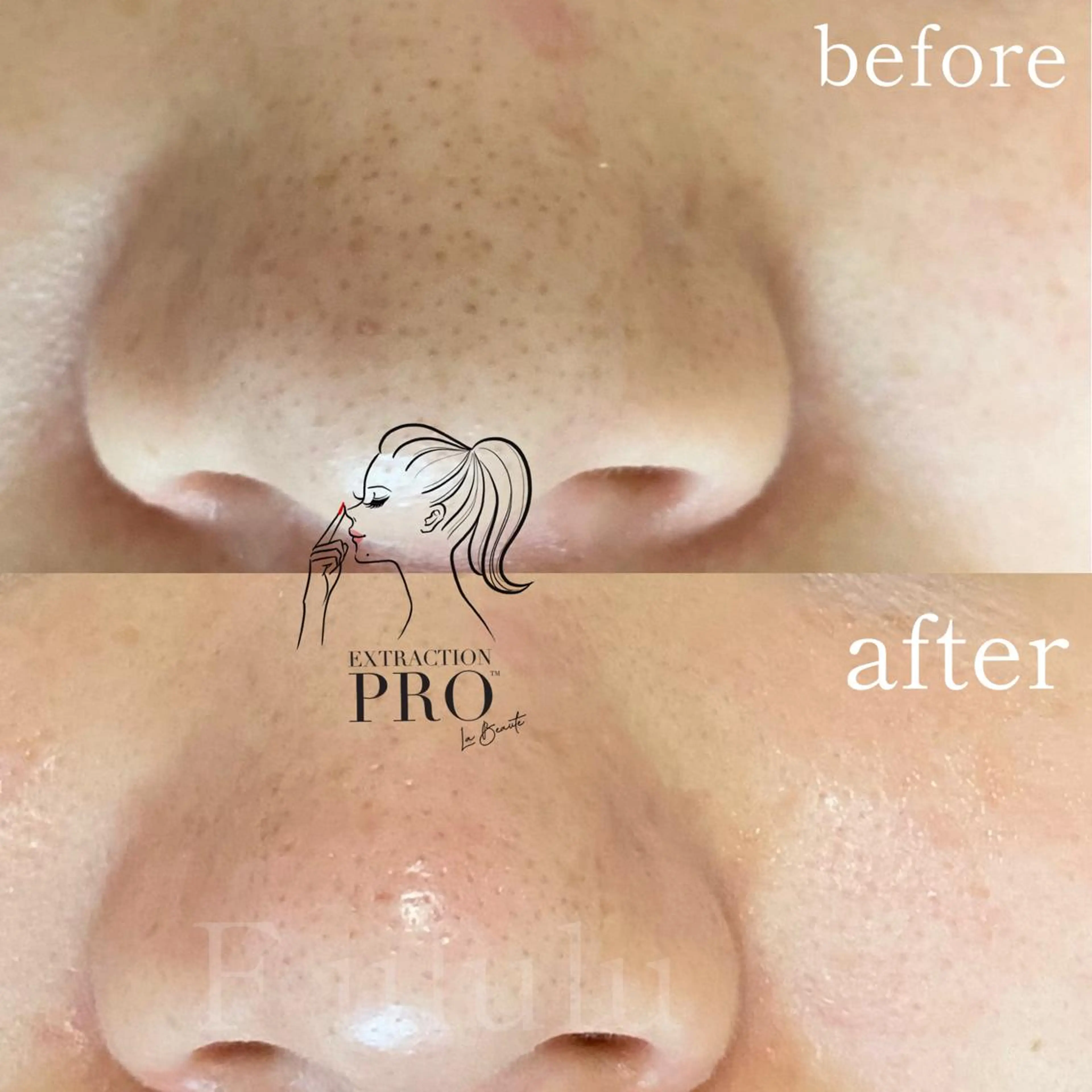 毛穴専門サロン　フルール所属・フルールFululu 自由が丘のエステ・リラクイメージ