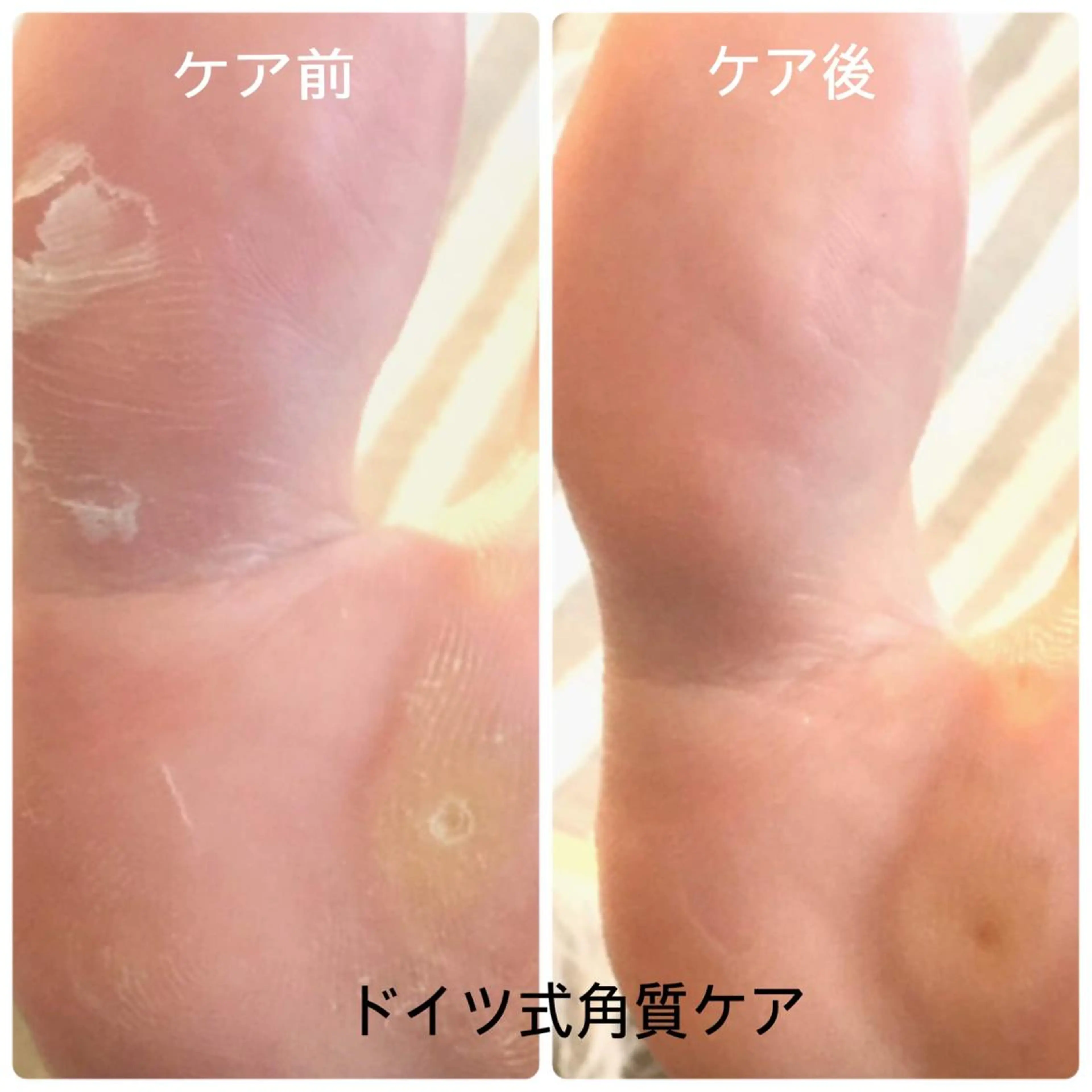 ネイル & nudge nail所属・&nudgenail 本多のネイルデザイン