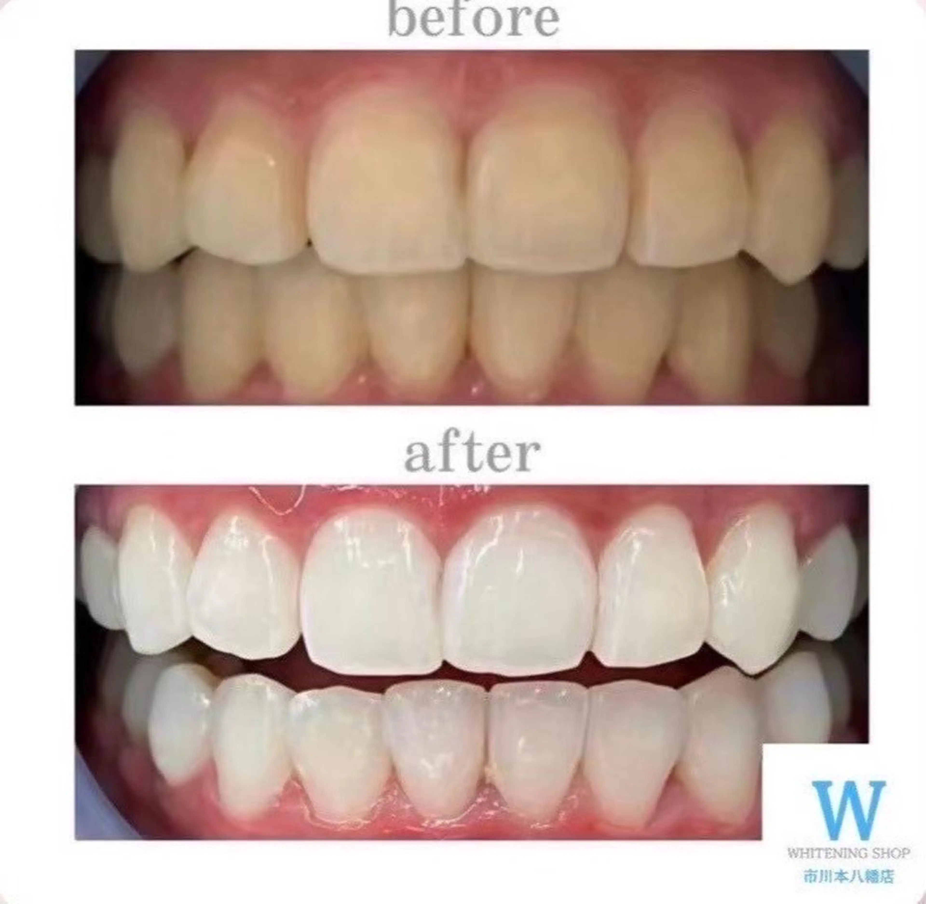 ホワイトニング ショップ本八幡店のエステ・リラクイメージ