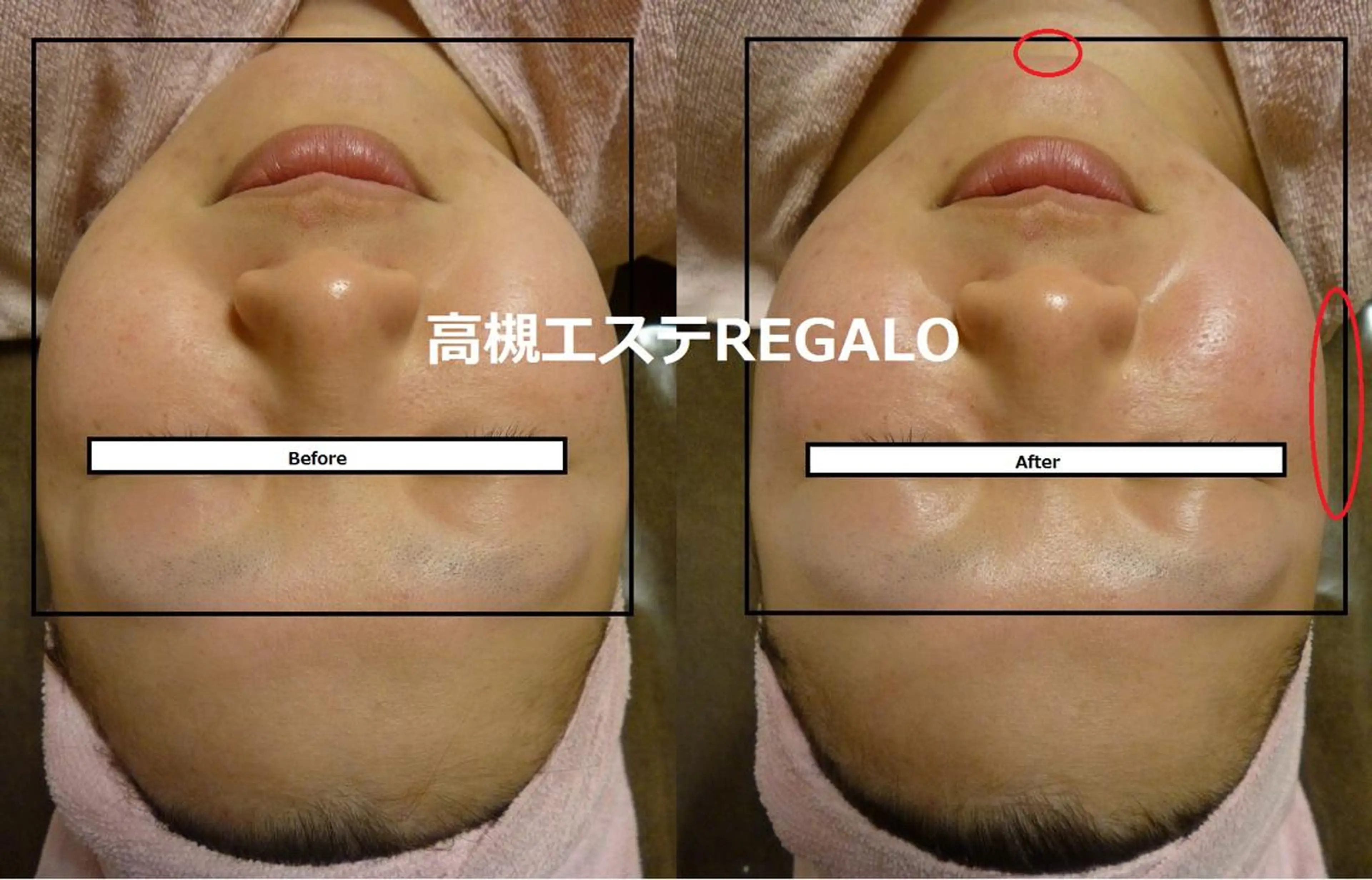 REGALO所属・矢野 さやかのエステ・リラクイメージ