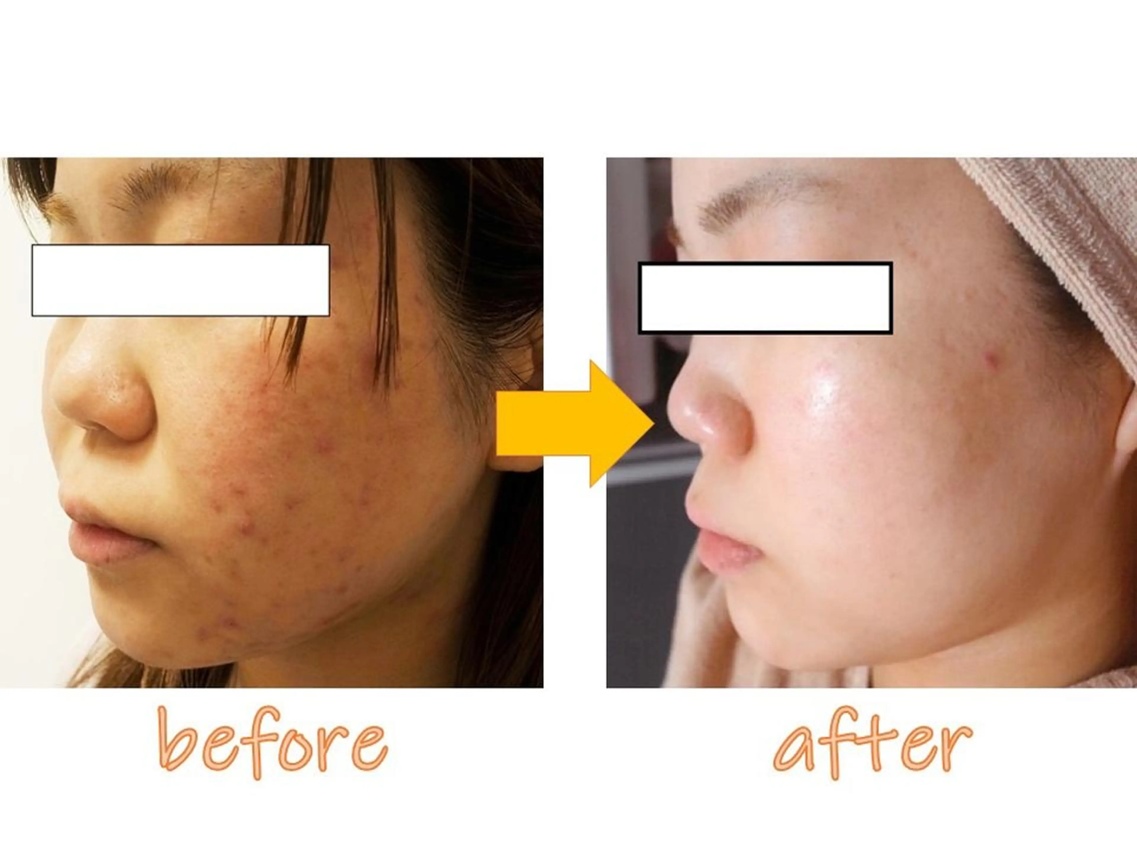 ニキビ専門サロン ド　ミモザのエステ・リラクイメージ