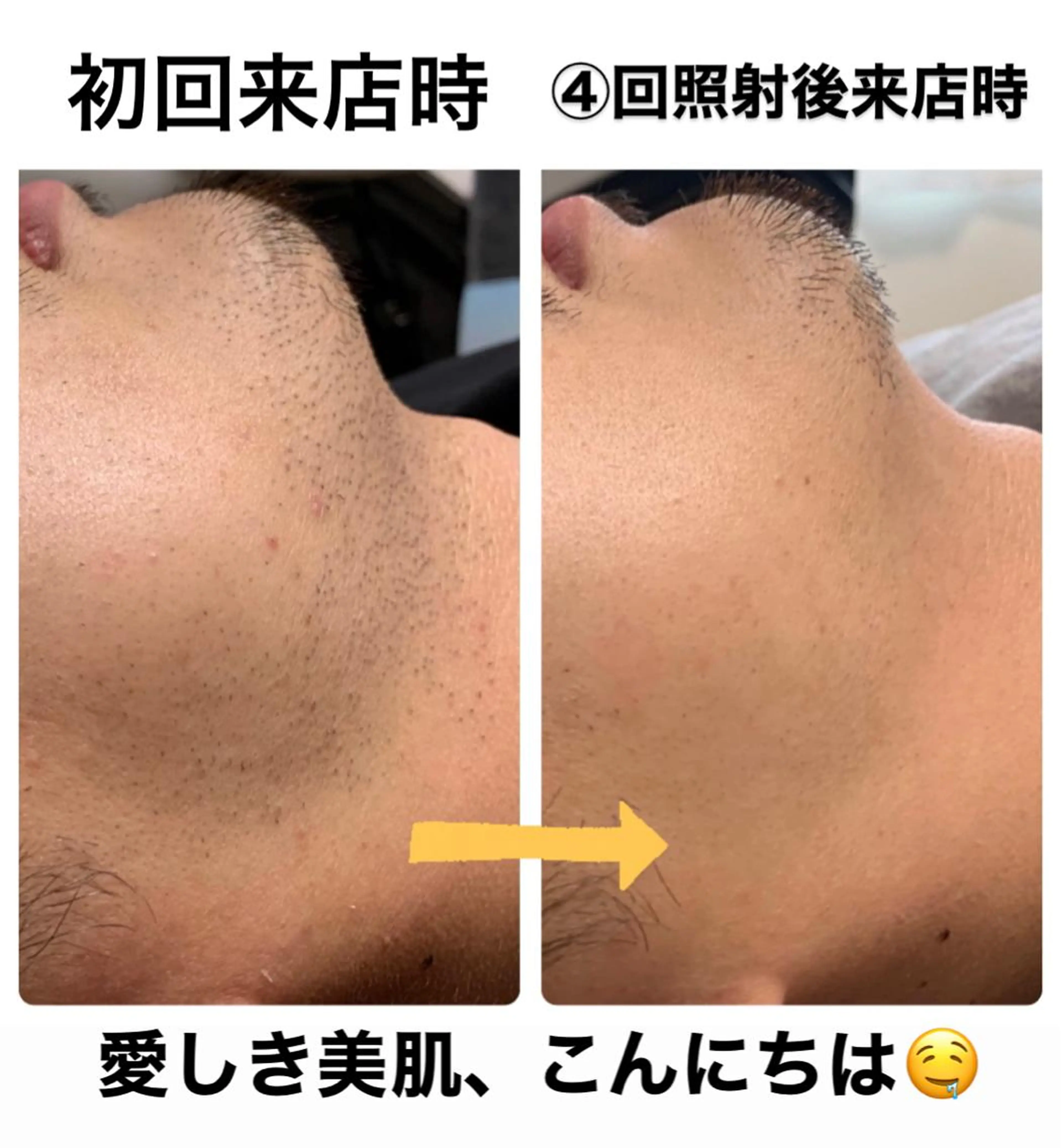 メンズ メンズハイライト メンズ脱毛サロン Le falcoのエステ・リラクイメージ