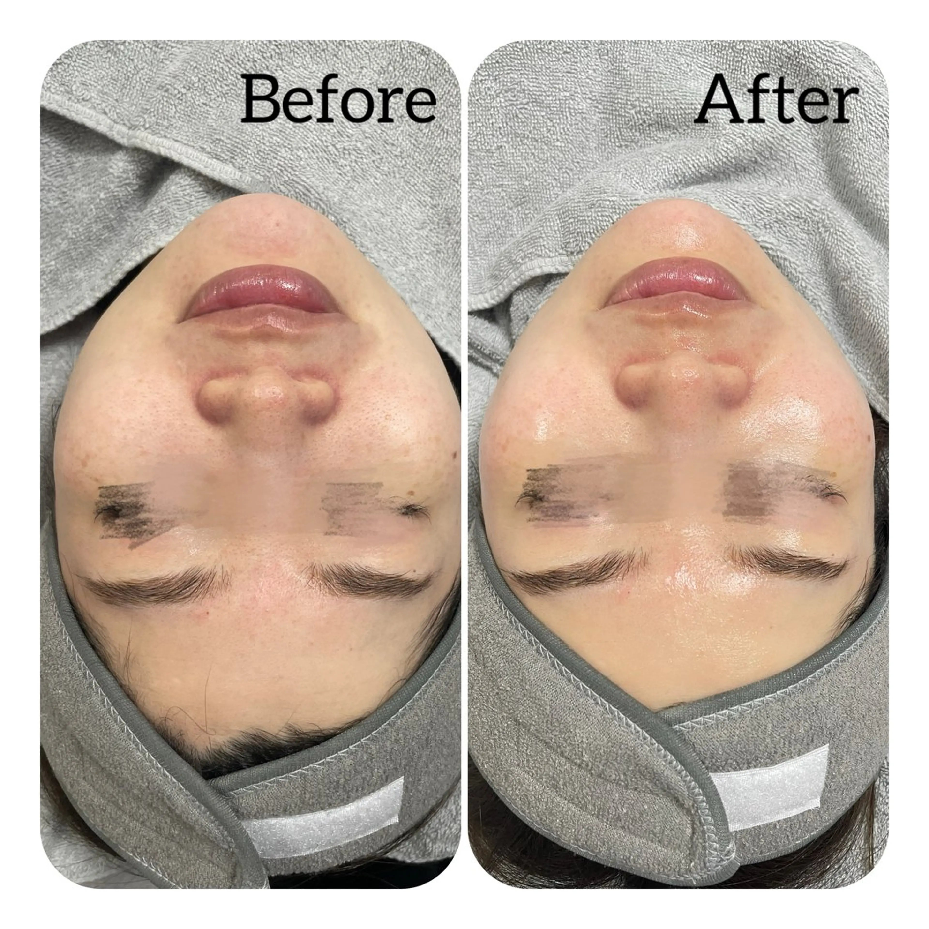 エステ Éclat de Belle🫧白玉肌のエステ・リラクイメージ