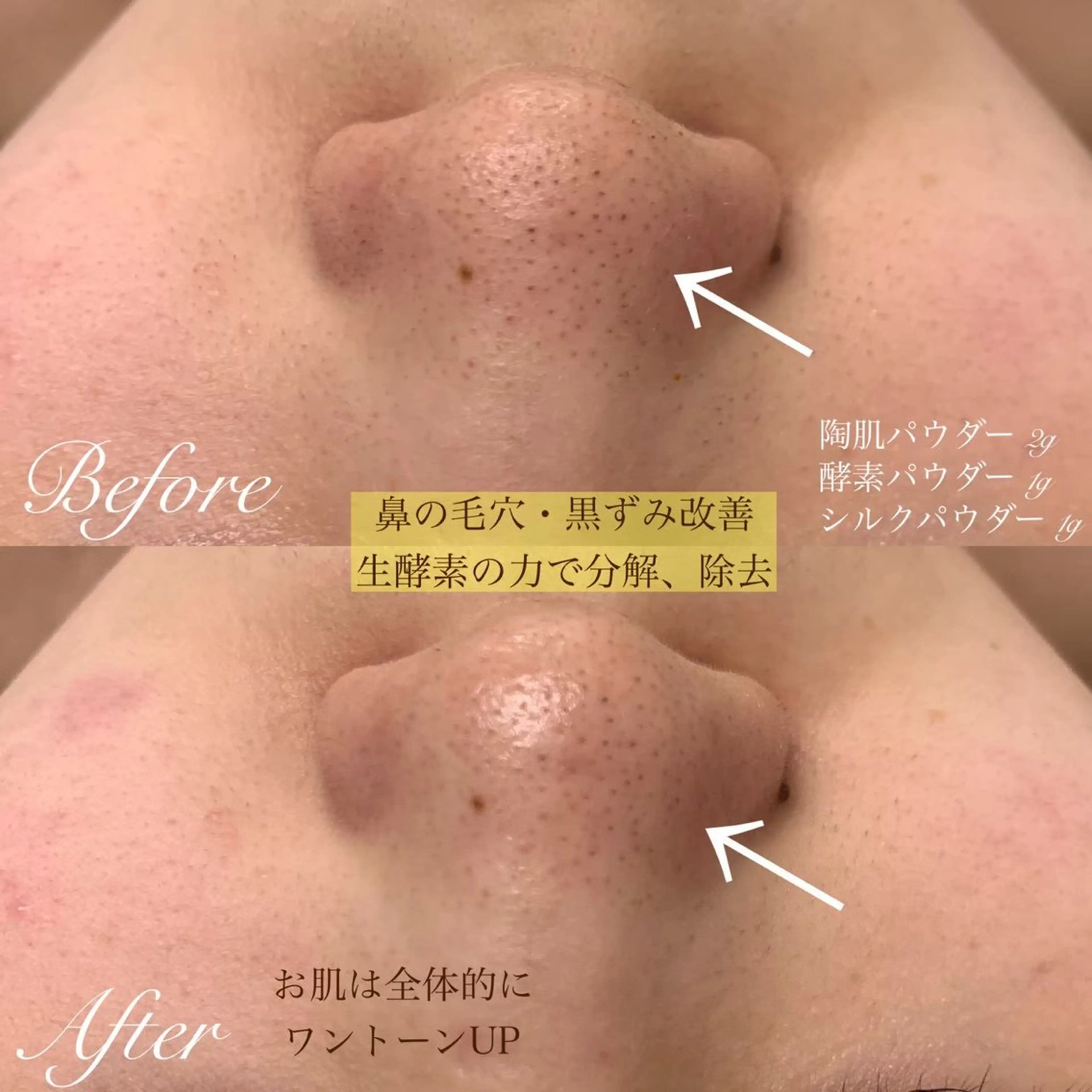 one day所属・肌質改善ハーブサロン ALA原宿のエステ・リラクイメージ