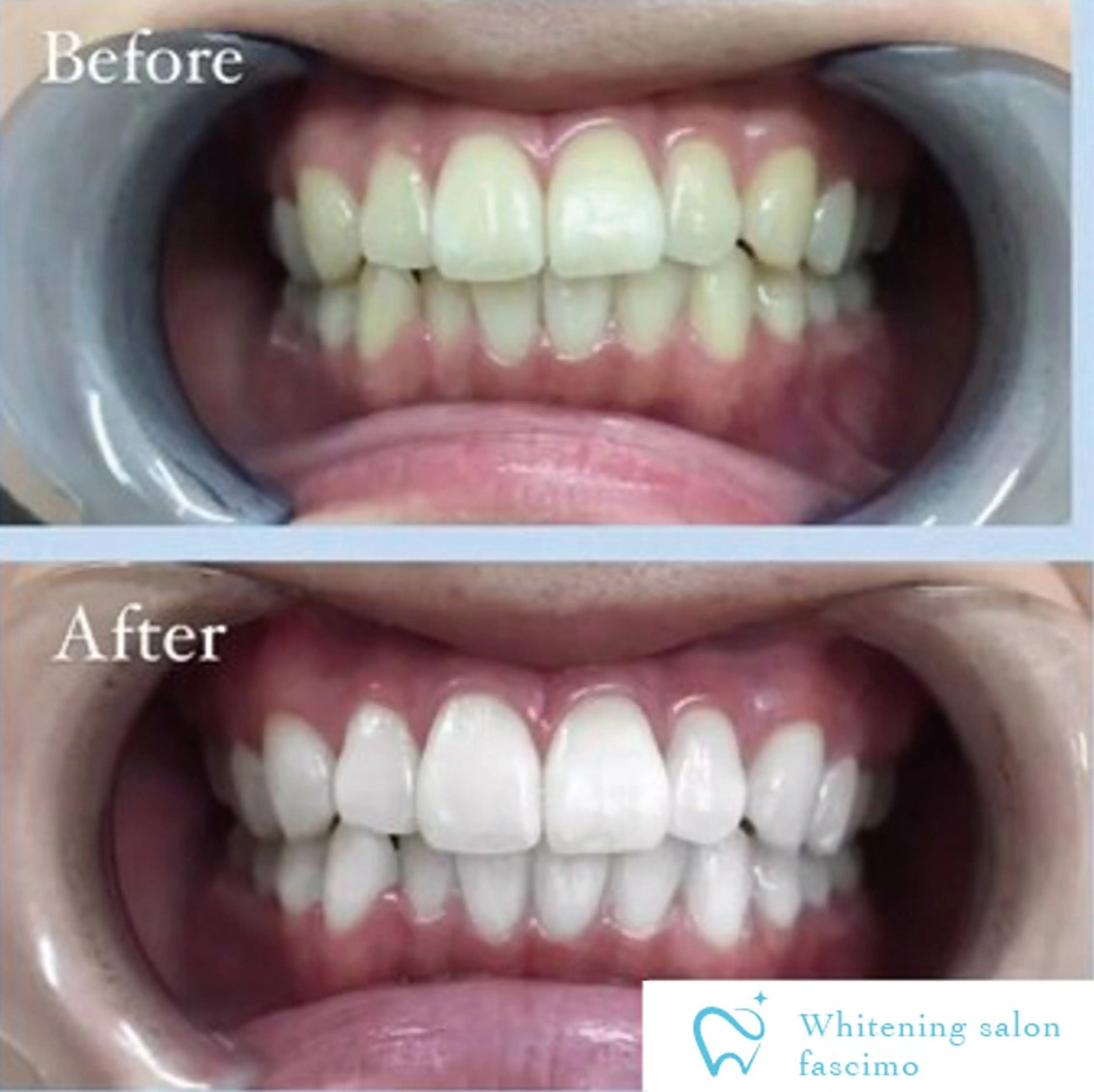 セルフホワイトニングサロンfascimo所属・ホワイトニングサロン fascimo新座店のその他イメージ