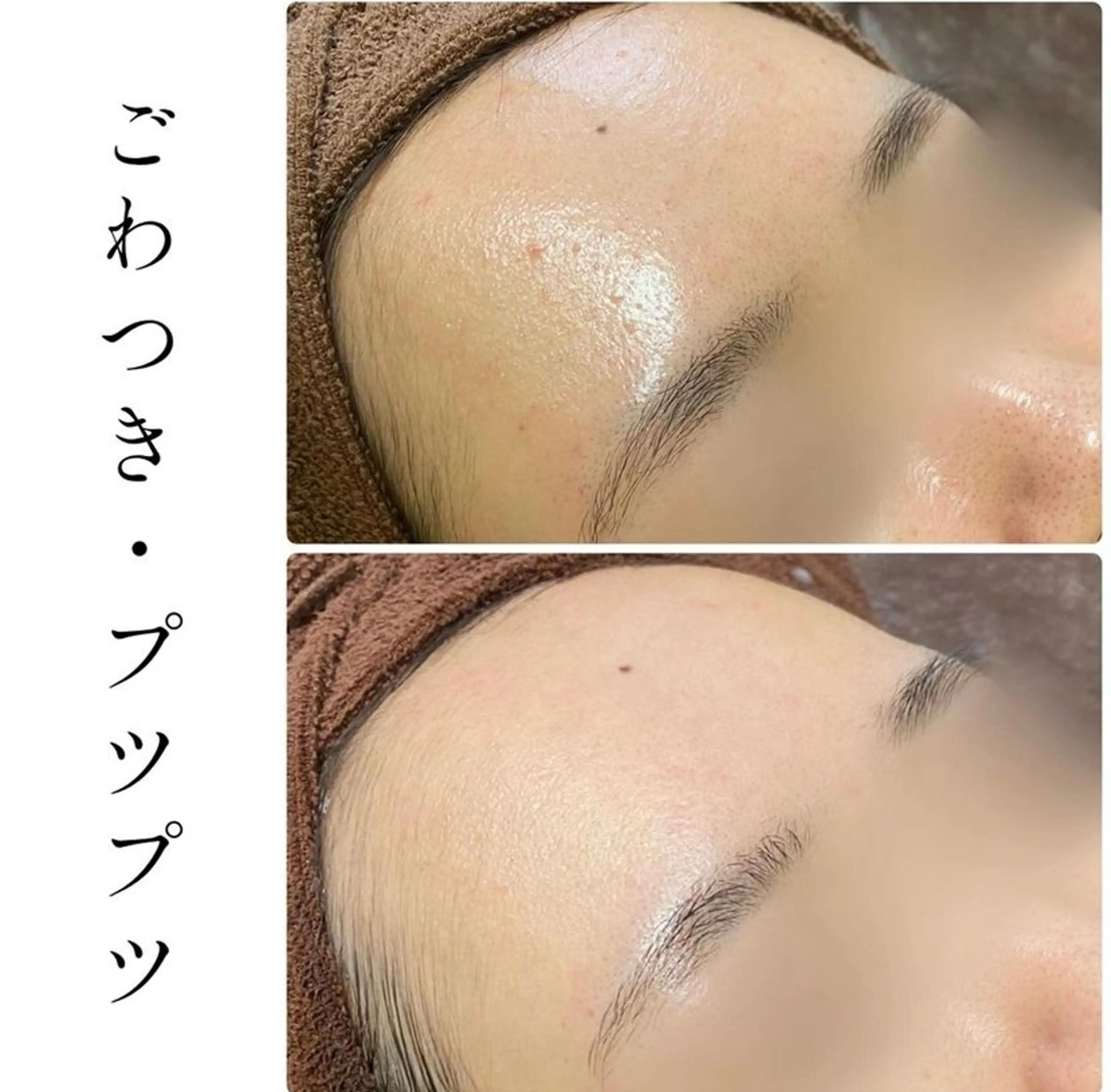 エステ ハーブピーリング専門 BIOPLUS＋川崎のエステ・リラクイメージ