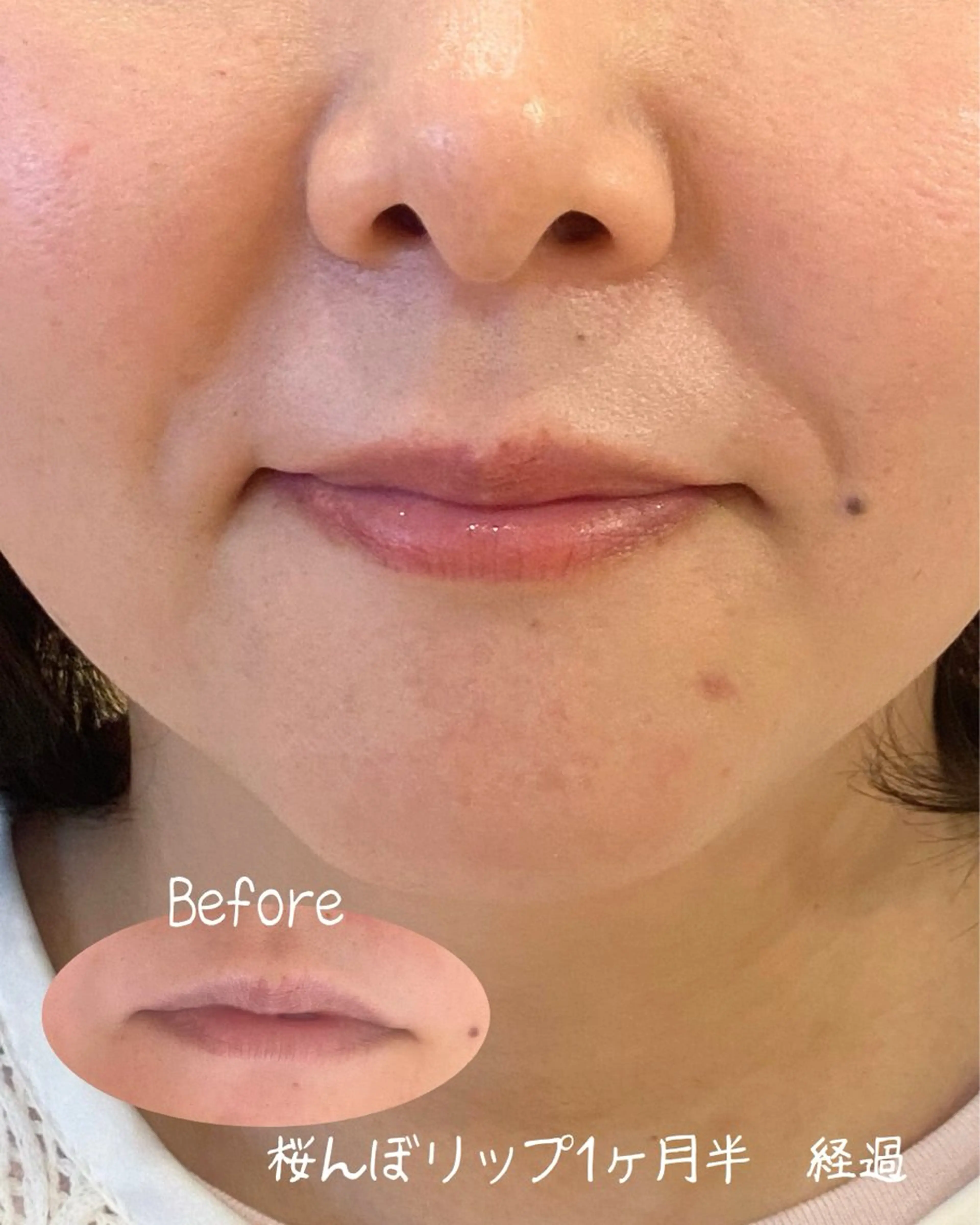 【血色が悪い方に】🌸桜んぼリップカウンセリング＋ドライヘッドマッサージ30分／2,000円🌸の写真