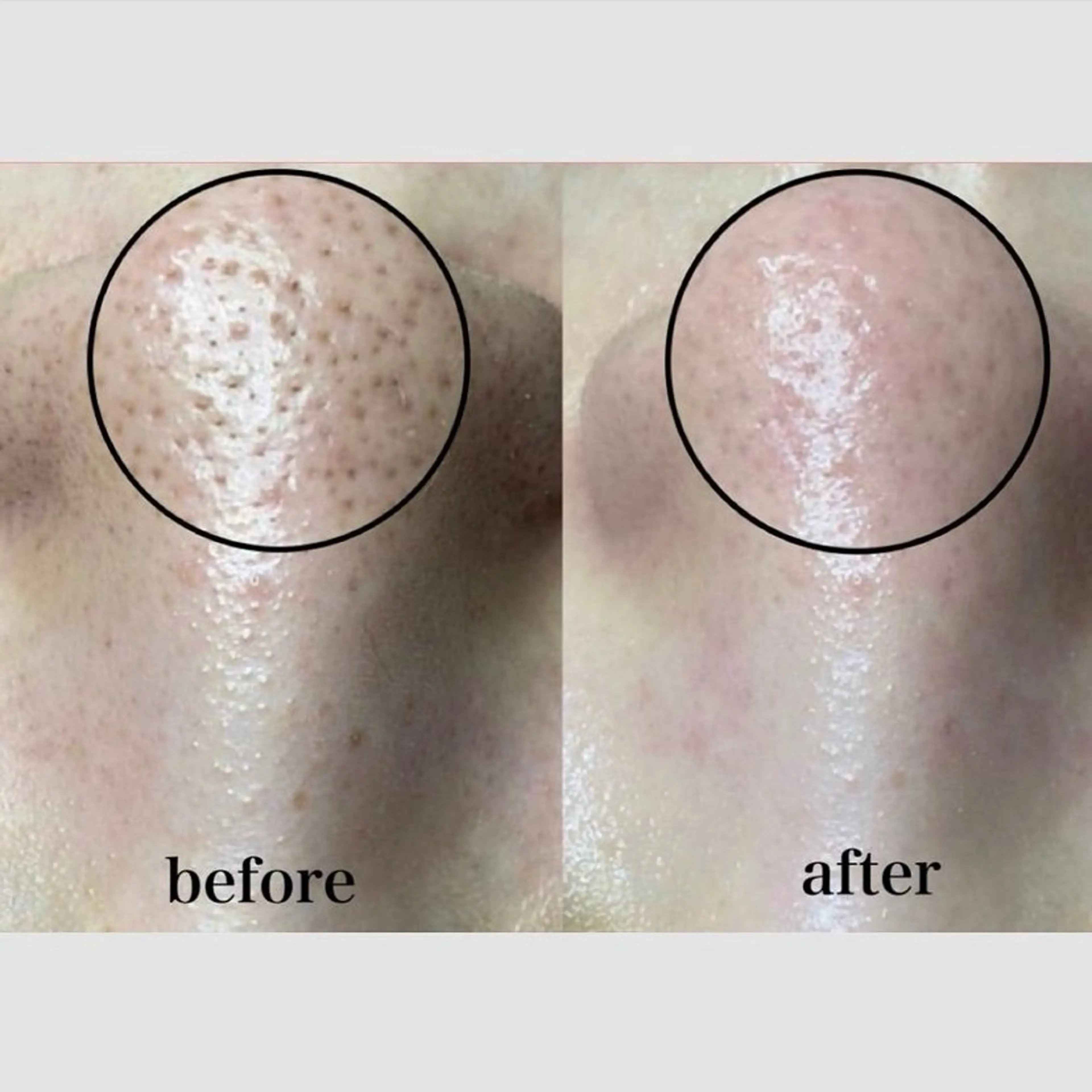 エステ リラク 韓国肌管理 【毛穴専科】のエステ・リラクイメージ