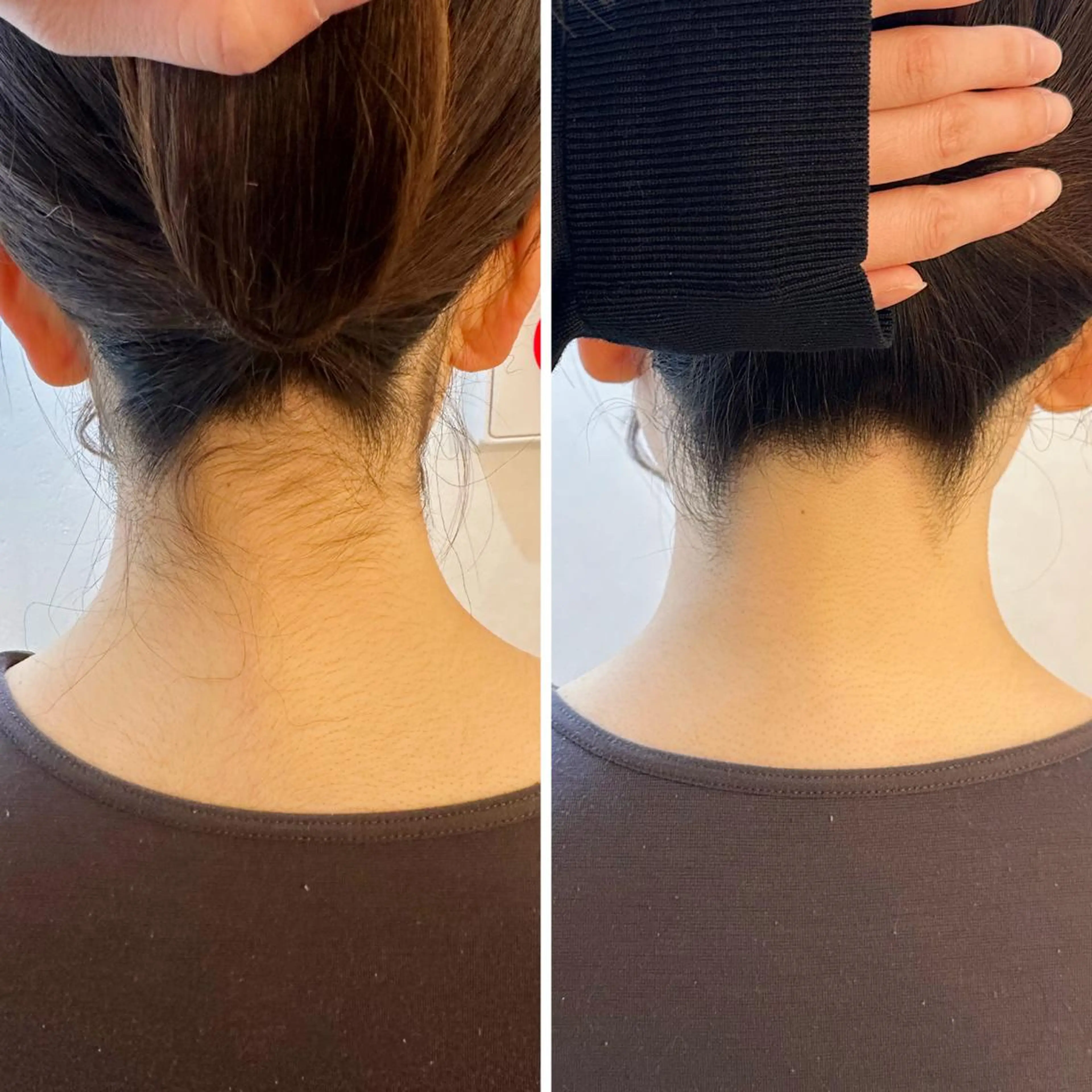 脱毛 うなじ脱毛/美肌脱毛 LABELのエステ・リラクイメージ