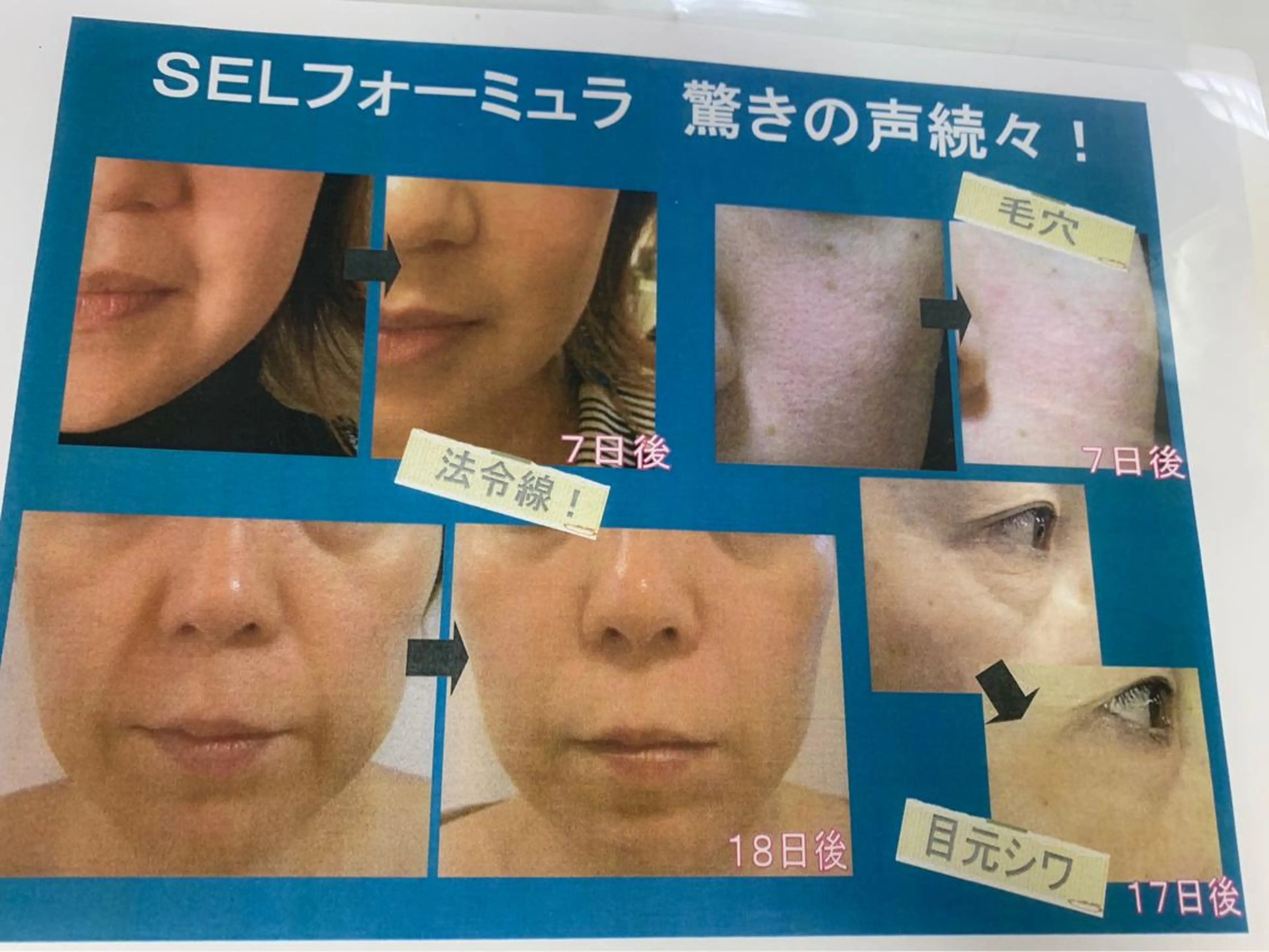 skinLabo所属・saya Mのエステ・リラクイメージ