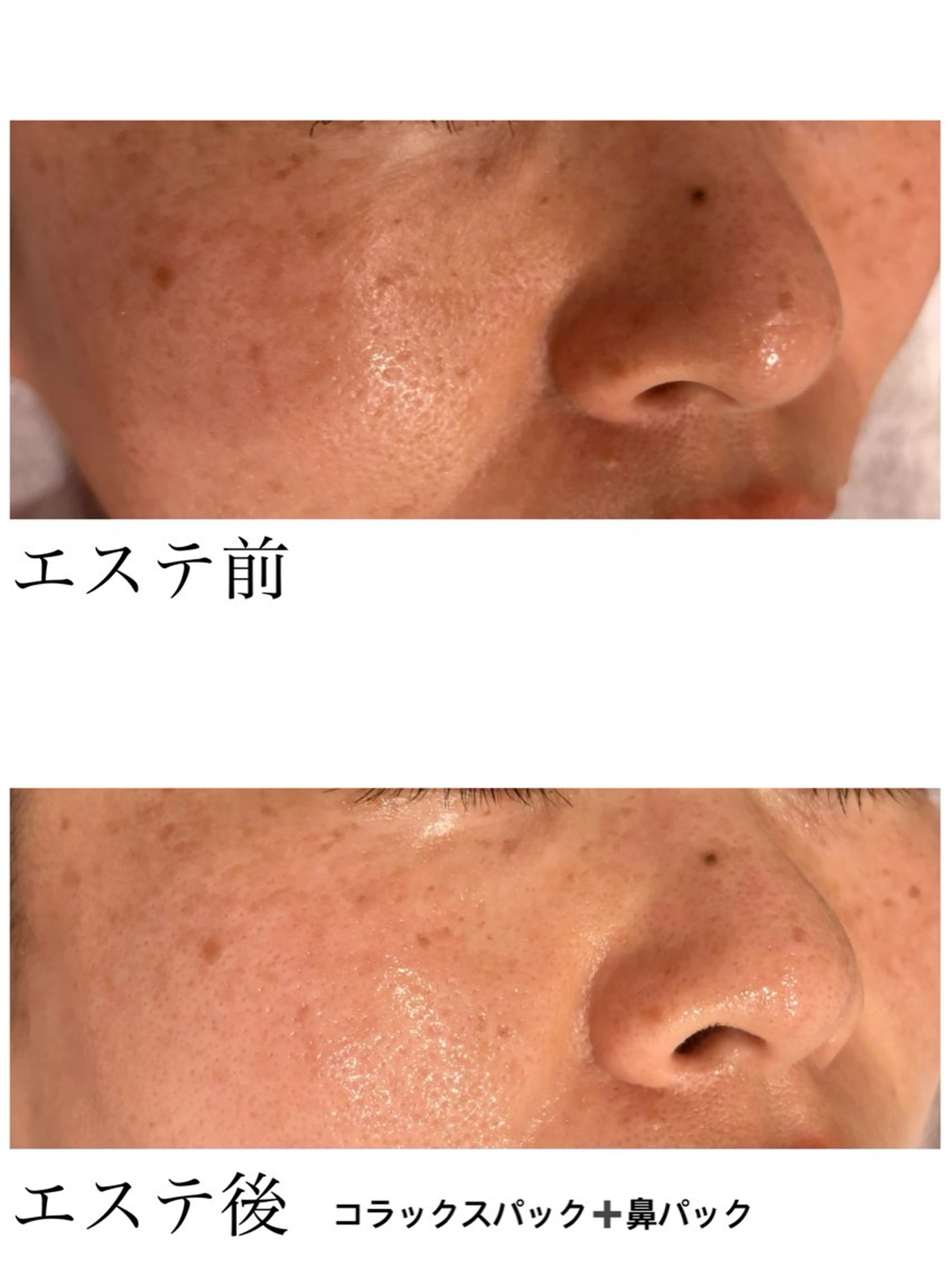 YUI🤍肌悩みに ＊速攻透明感！のエステ・リラクイメージ