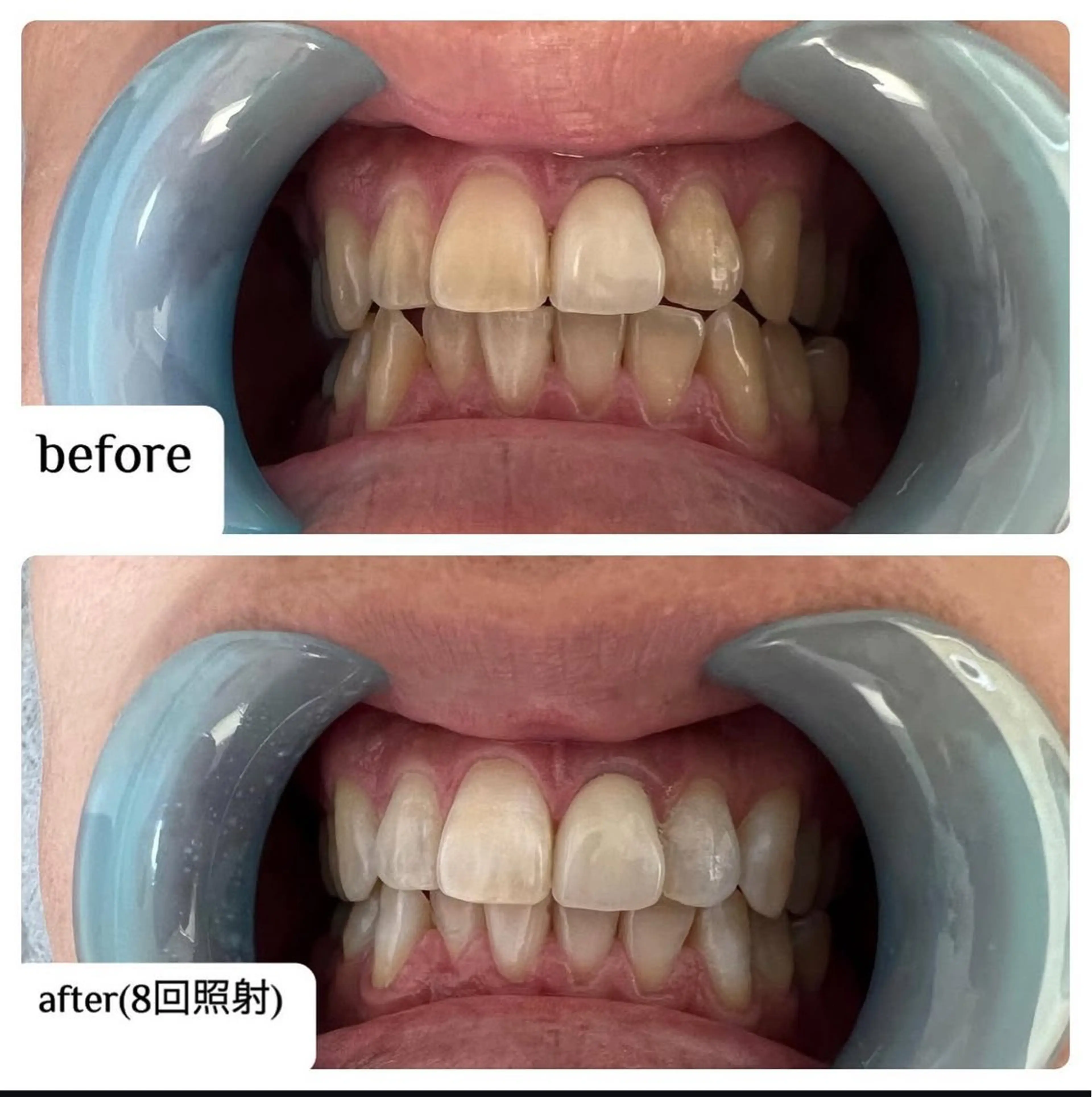 メンズ ☀️Akala☀️ メンズ脱毛のエステ・リラクイメージ