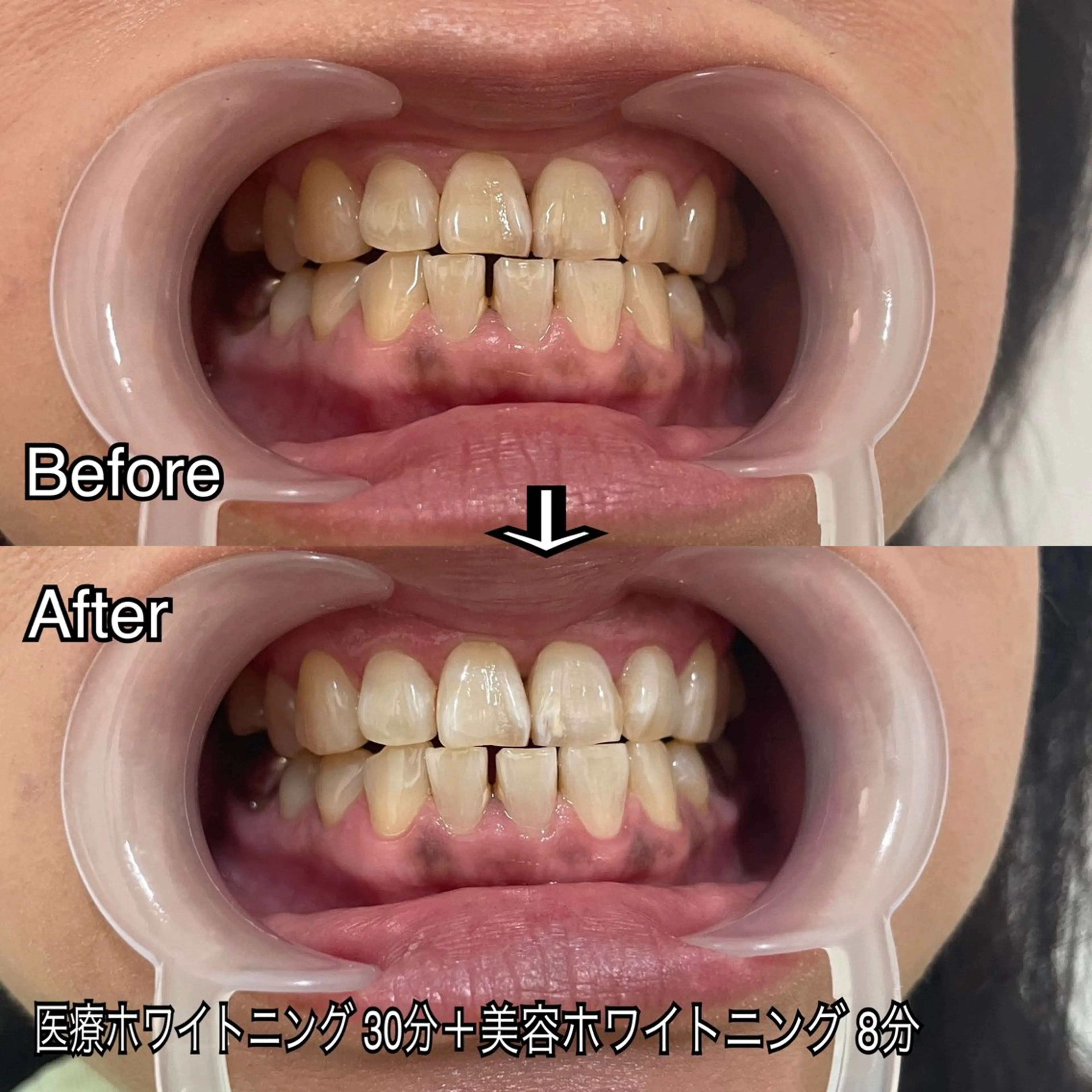 西宮ホワイトニング Kirarie所属・志水 有美のエステ・リラクイメージ