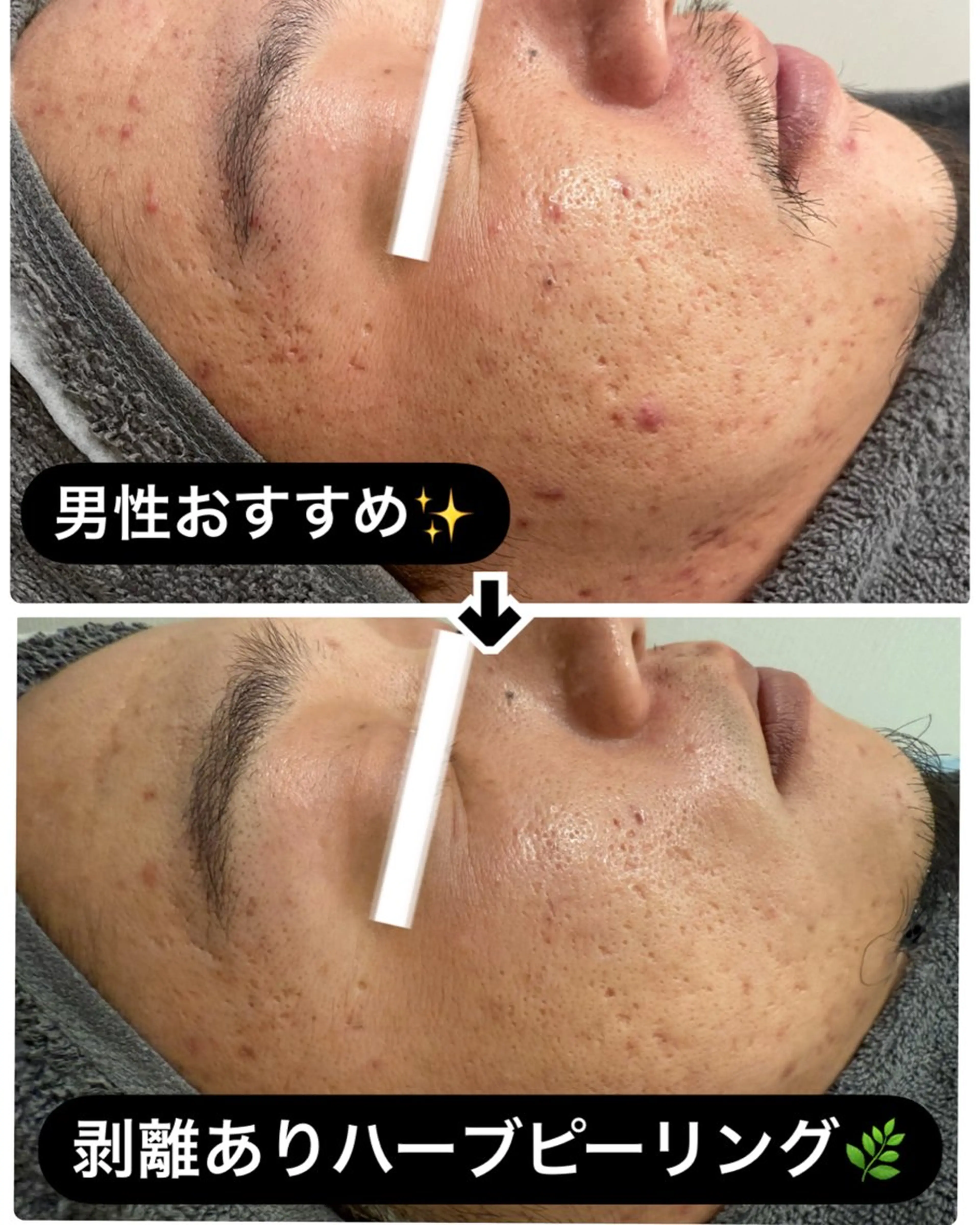 エステ NHerb【エヌハーブ】所属・横田 汐里のエステ・リラクイメージ