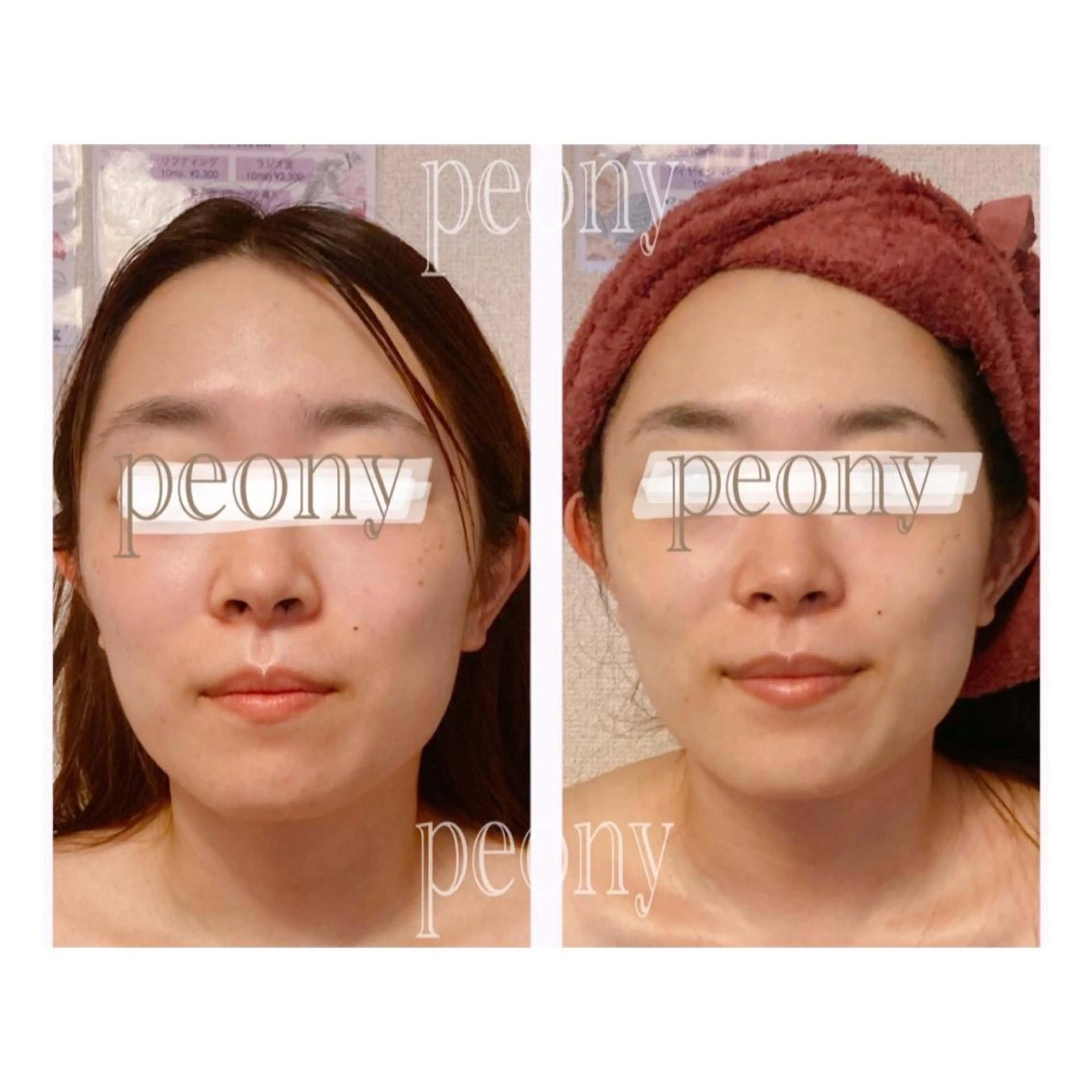 エステ リラク デトックス美容専門サロンｐｅｏｎｙ所属・デトックス美容専門 サロンｐｅｏｎｙのエステ・リラクイメージ