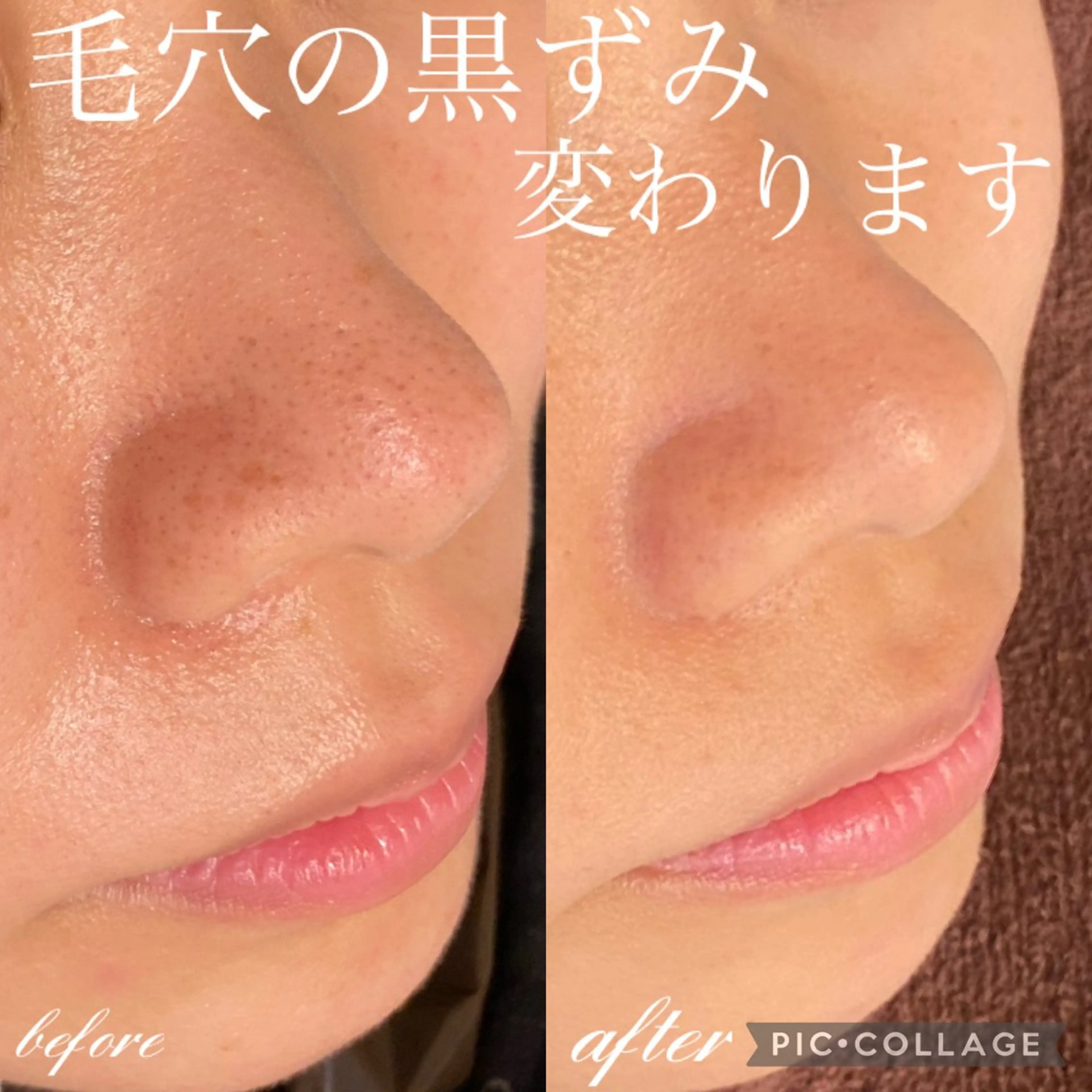 カラー パーマ ヘアアレンジ エステ リラク Ensor Clair所属・EnsorClair 代表　野口真央のエステ・リラクイメージ