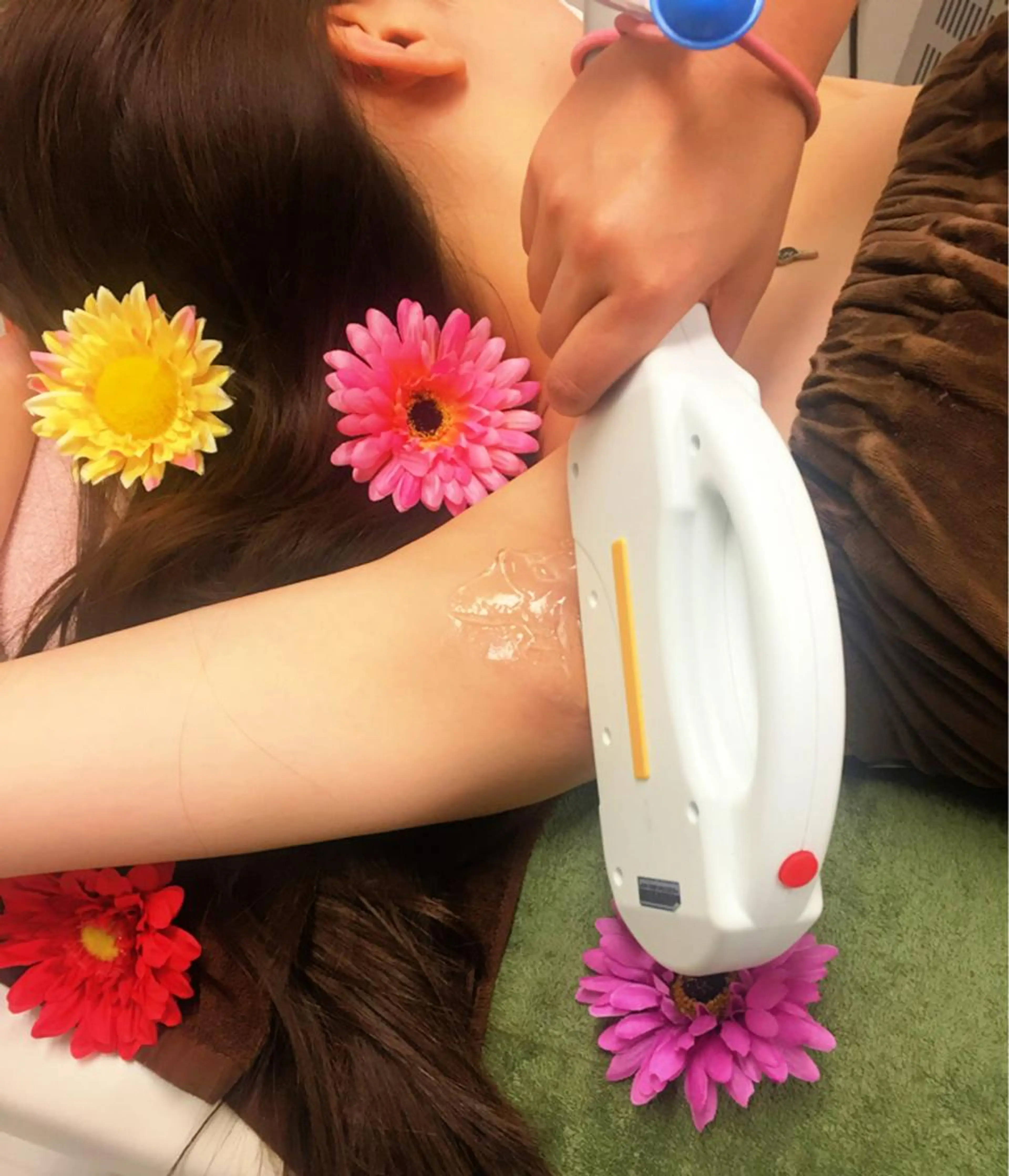 セレクト🌟パーツ脱毛の写真