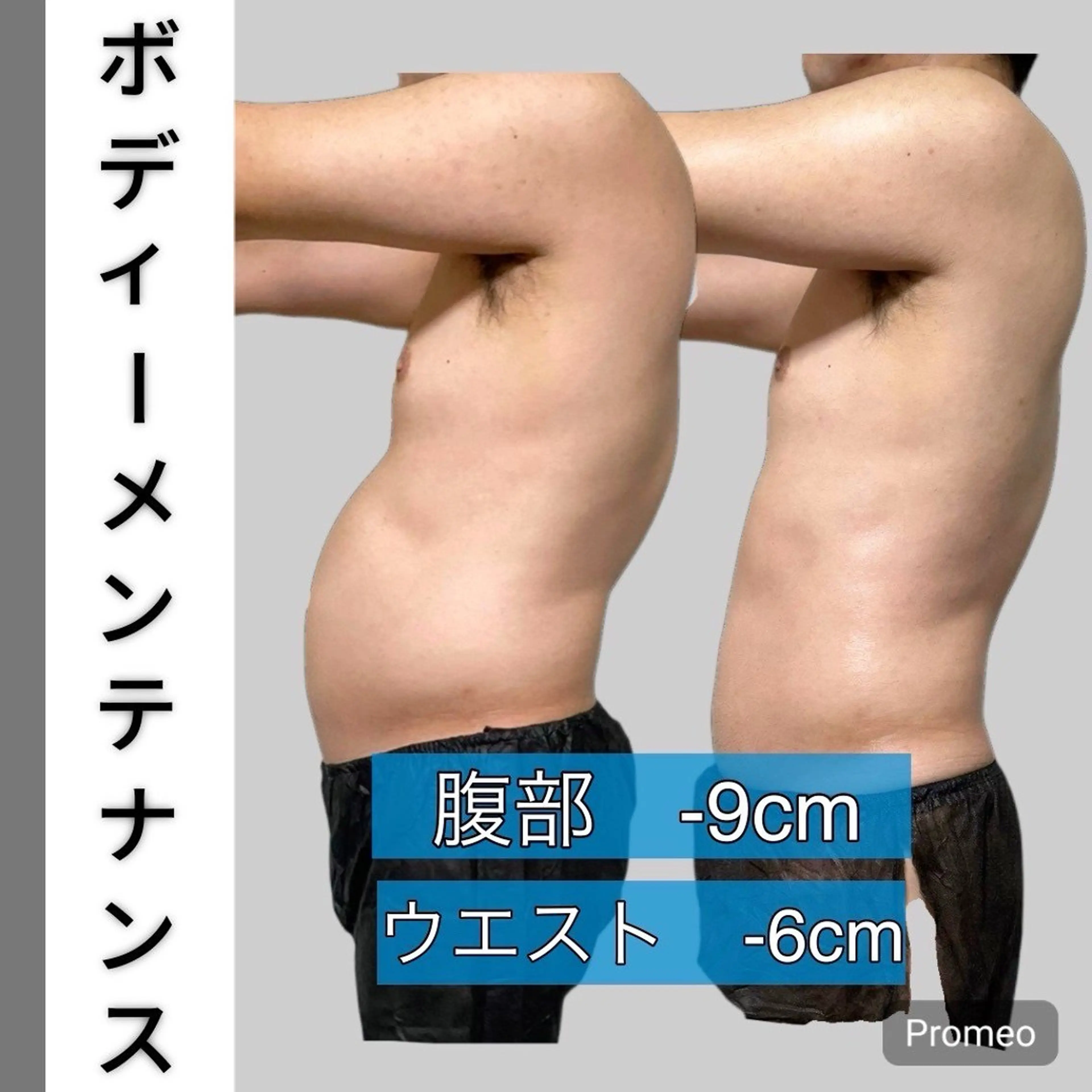 エステラボ　ei-B  王寺店所属・脱毛／脱毛 ／ボディメンテナンスのエステ・リラクイメージ