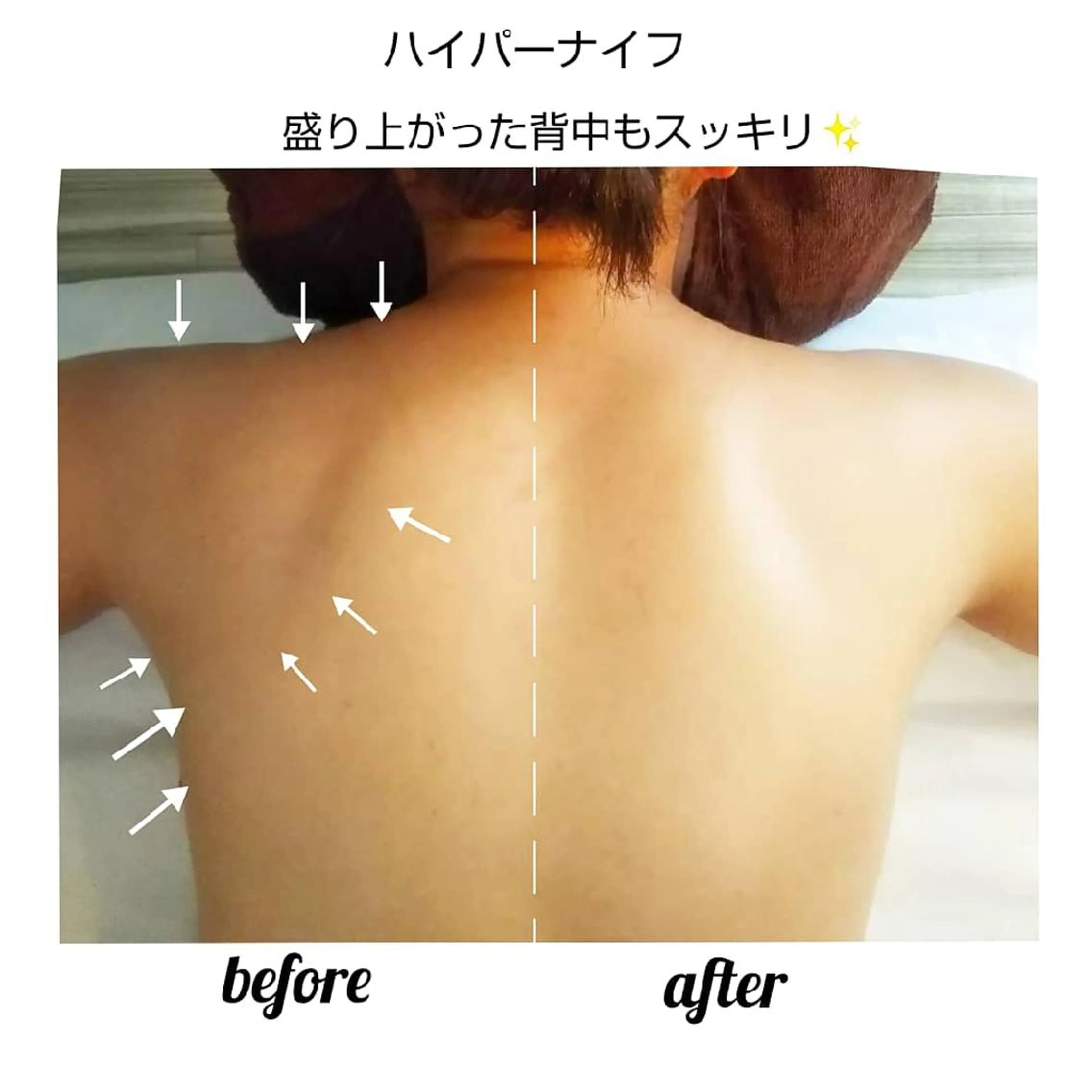 【ニキビ/肌管理】 salon varyのエステ・リラクイメージ