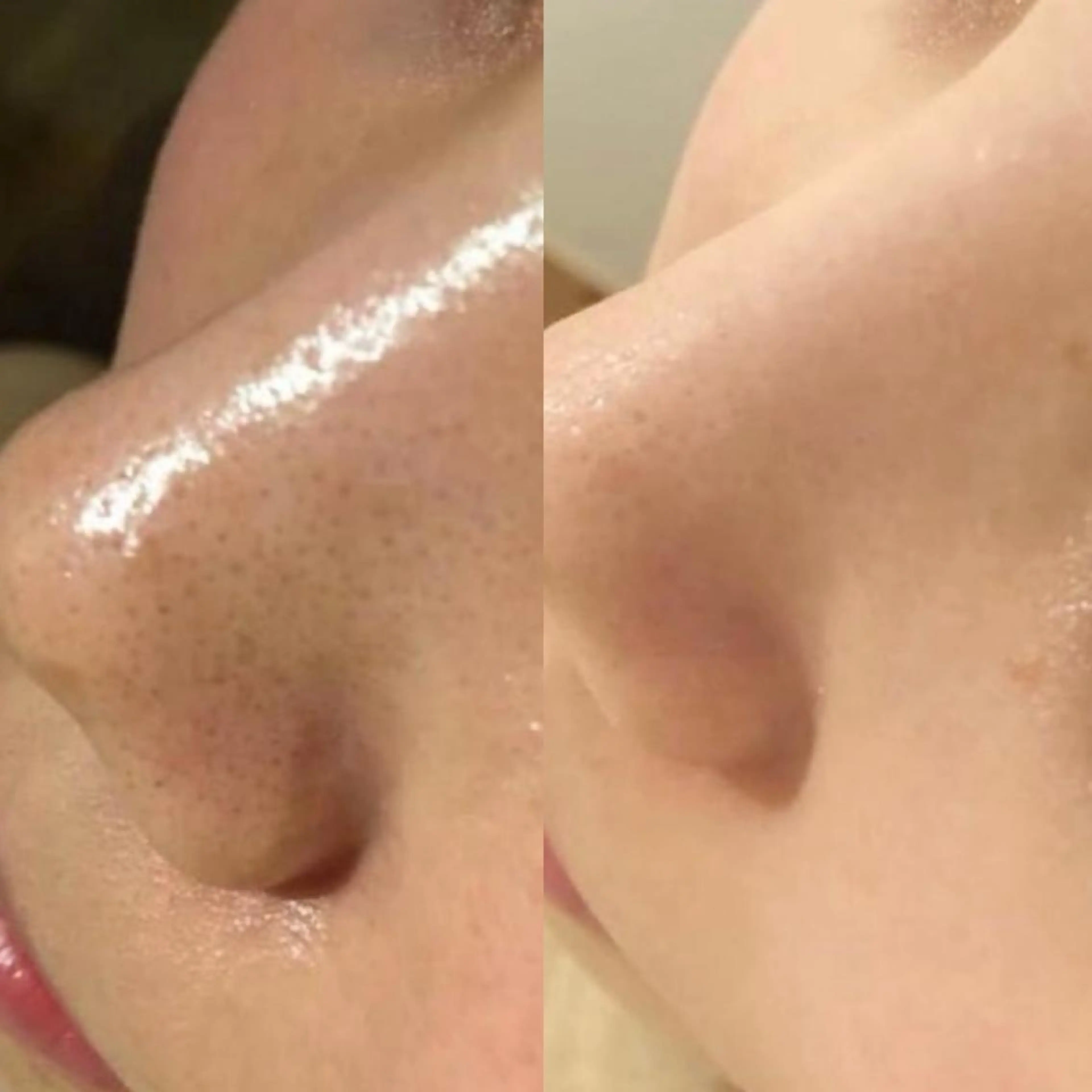 ニキビ・肌質改善専門 ♡人生が変わるサロンのエステ・リラクイメージ