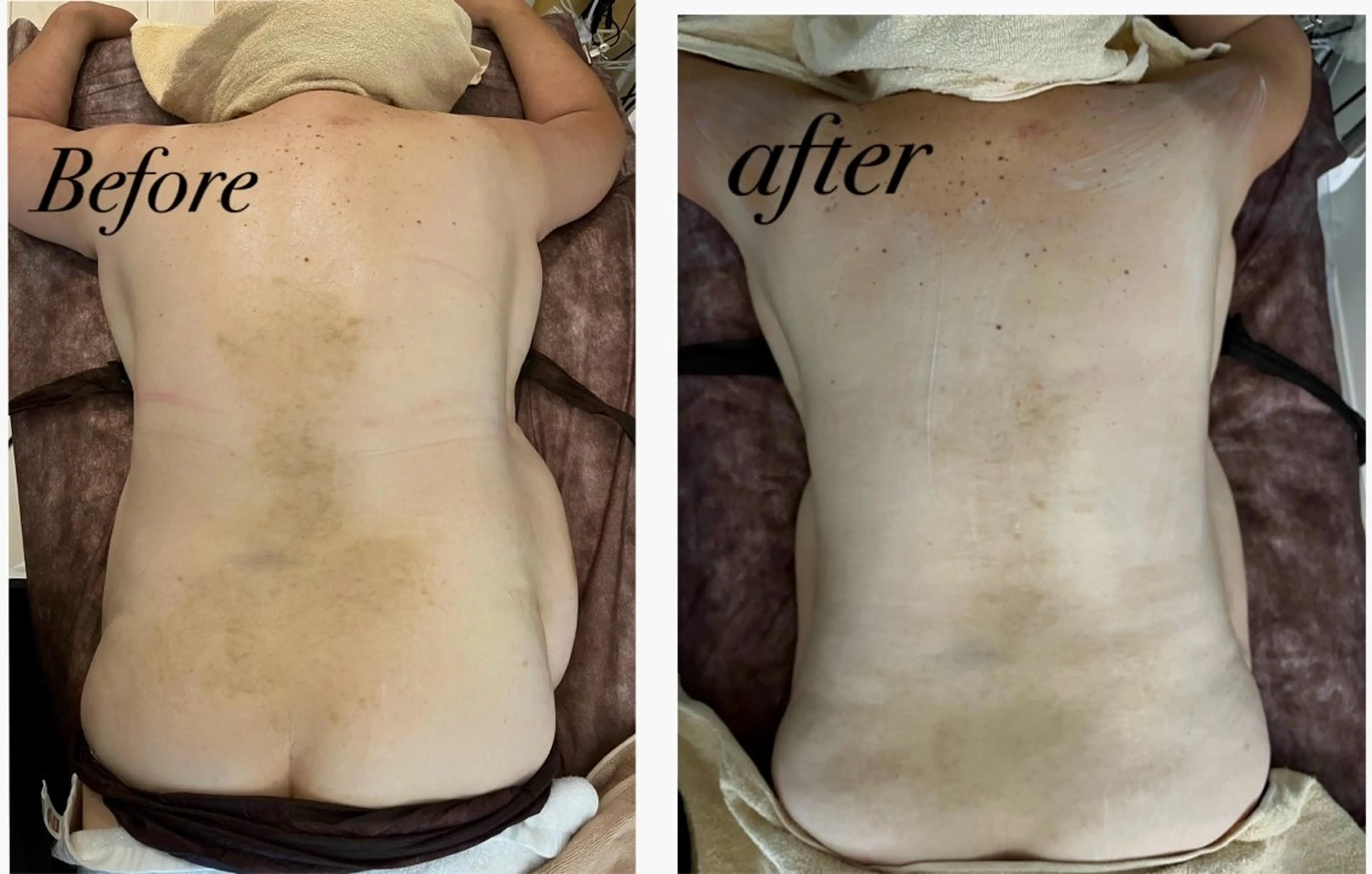 solo tu  salon MANA所属・美肌＆痩身＆脱毛 MANAのエステ・リラクイメージ