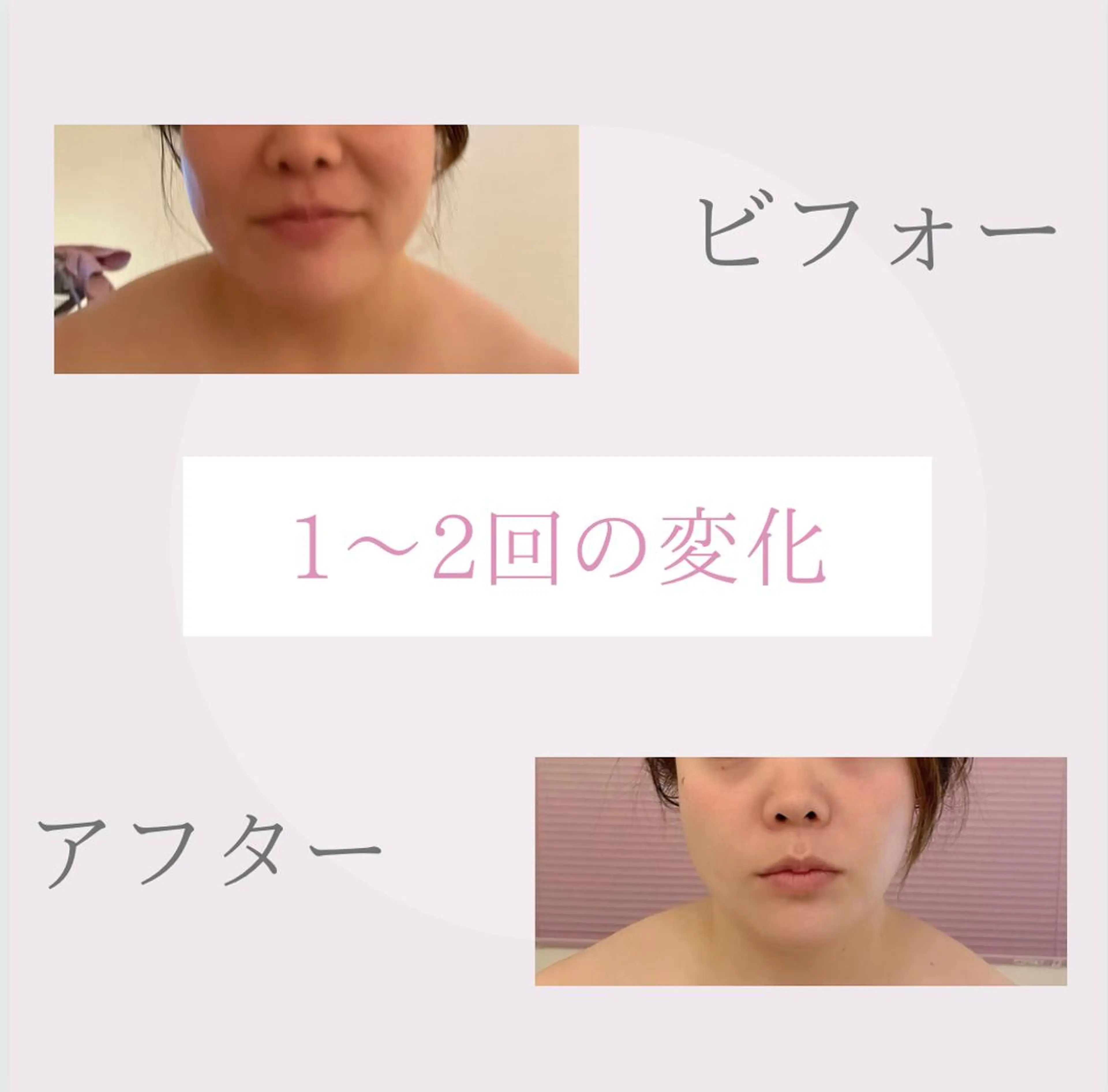 🎀BiBi韓国美容 コスパ強！美活サロンのエステ・リラクイメージ