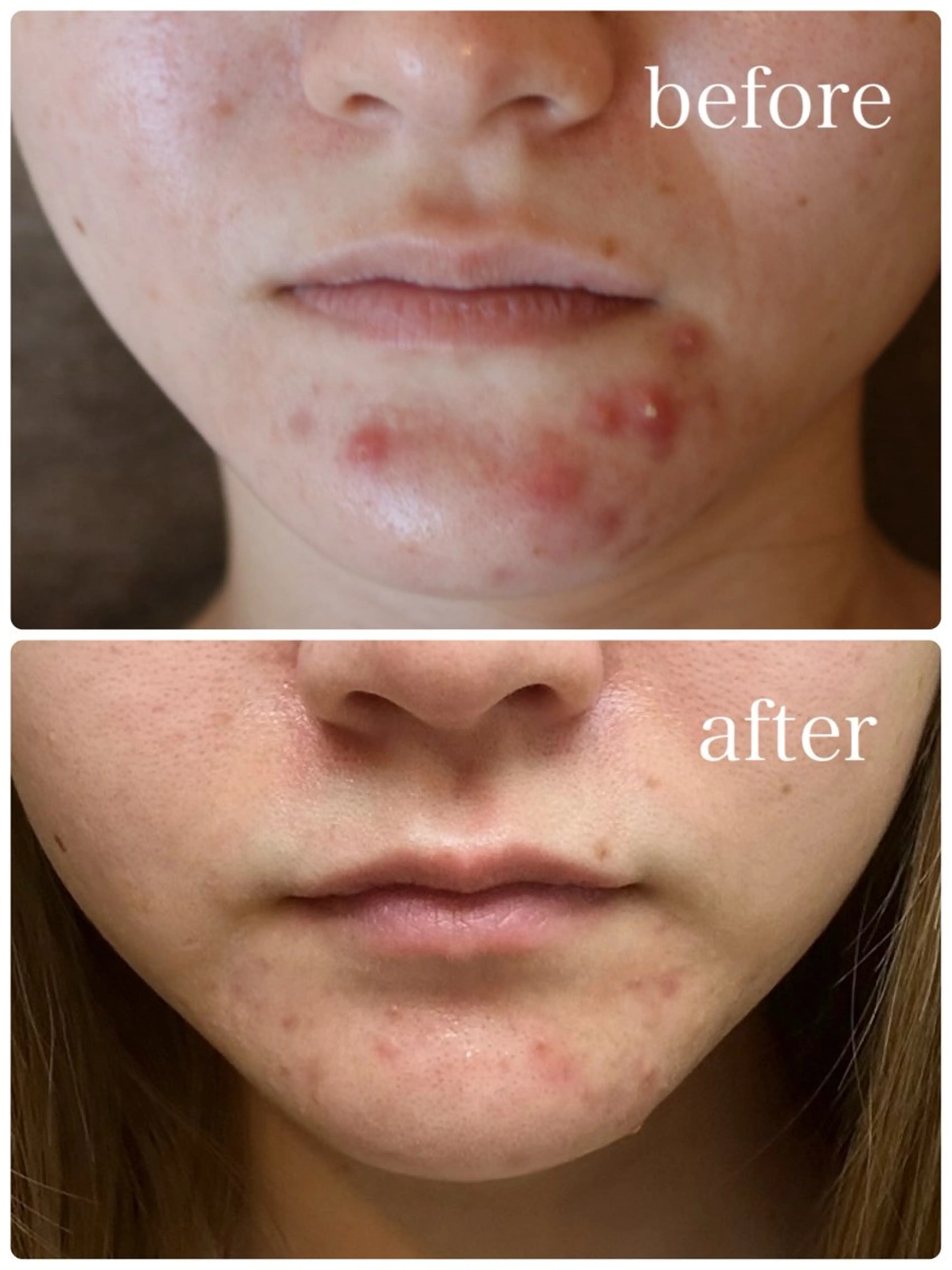 ハーブピーリング🌿 Vivaceのその他イメージ