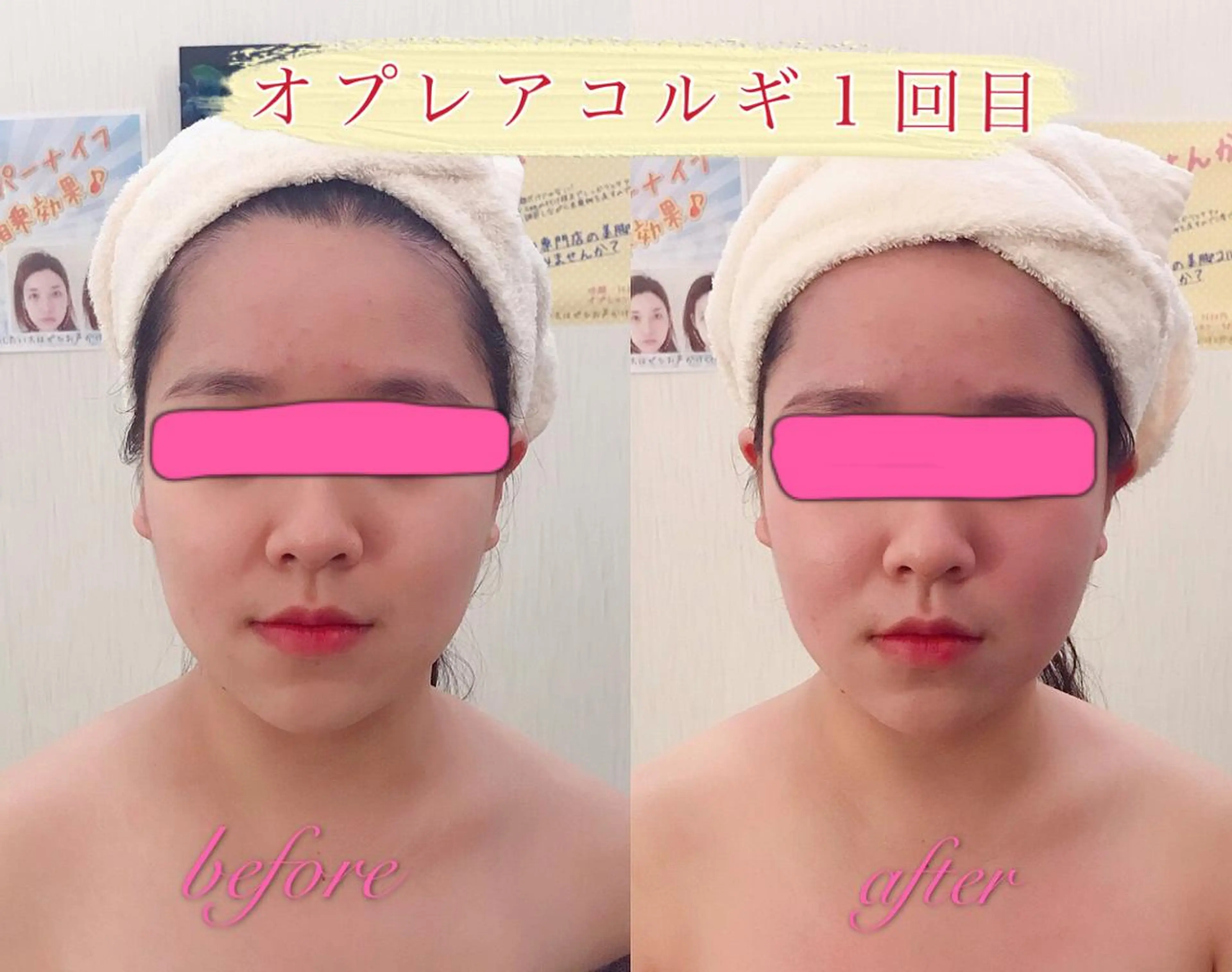 OPREA 栄店のエステ・リラクイメージ