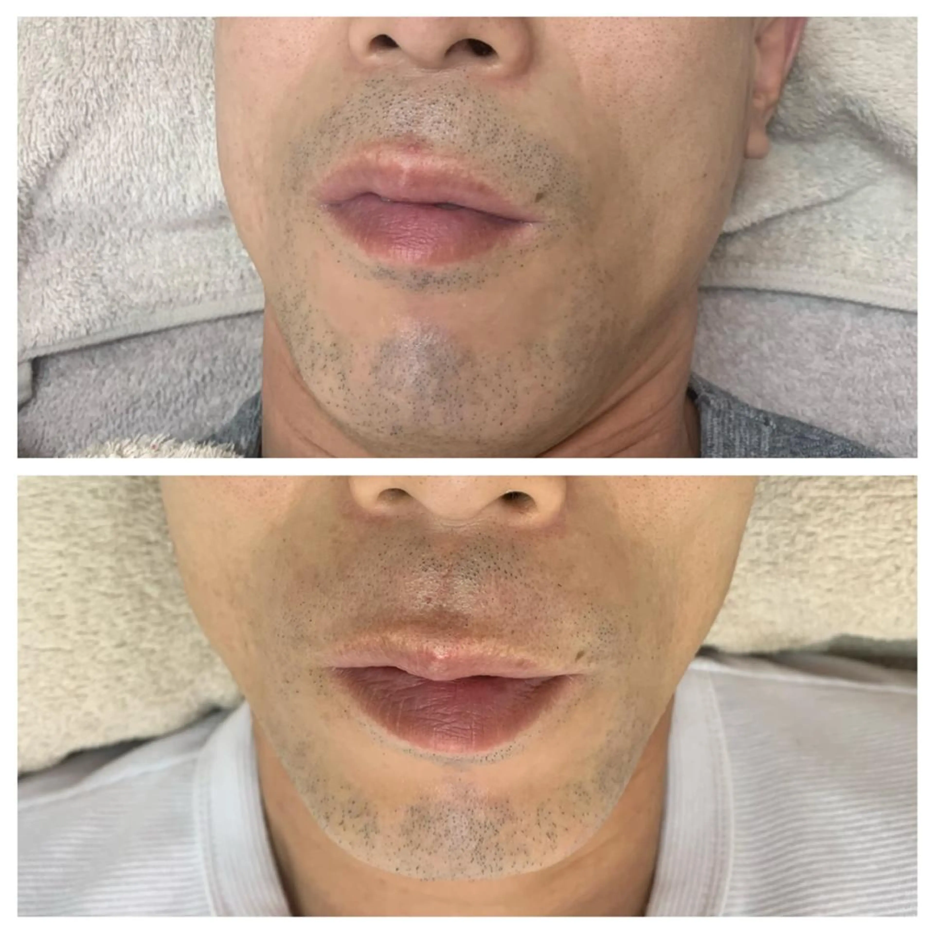 メンズ 脱毛 MISEREL岡崎店 Ayaのエステ・リラクイメージ