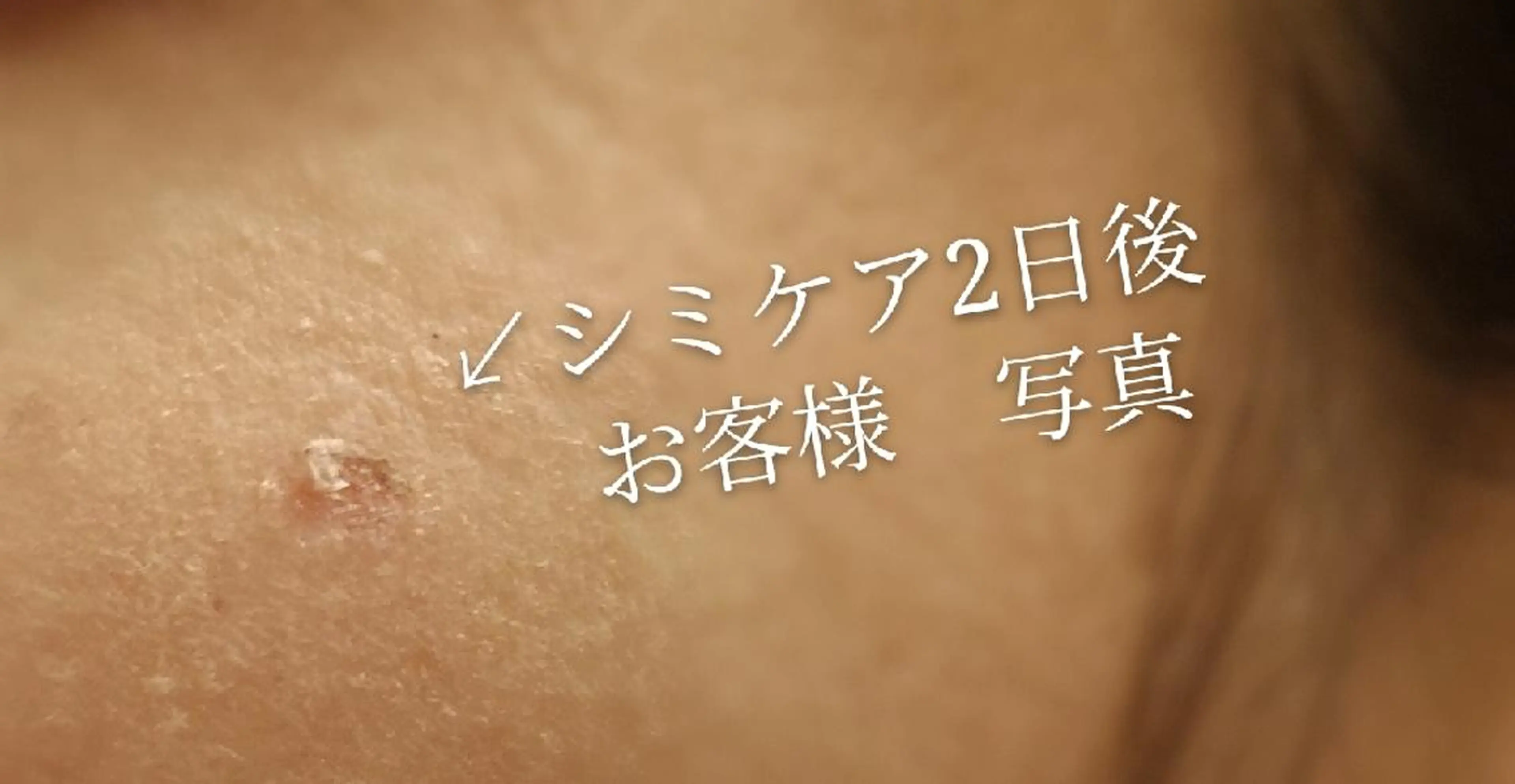 🅖🅤🅩🅔🅛 salonのエステ・リラクイメージ