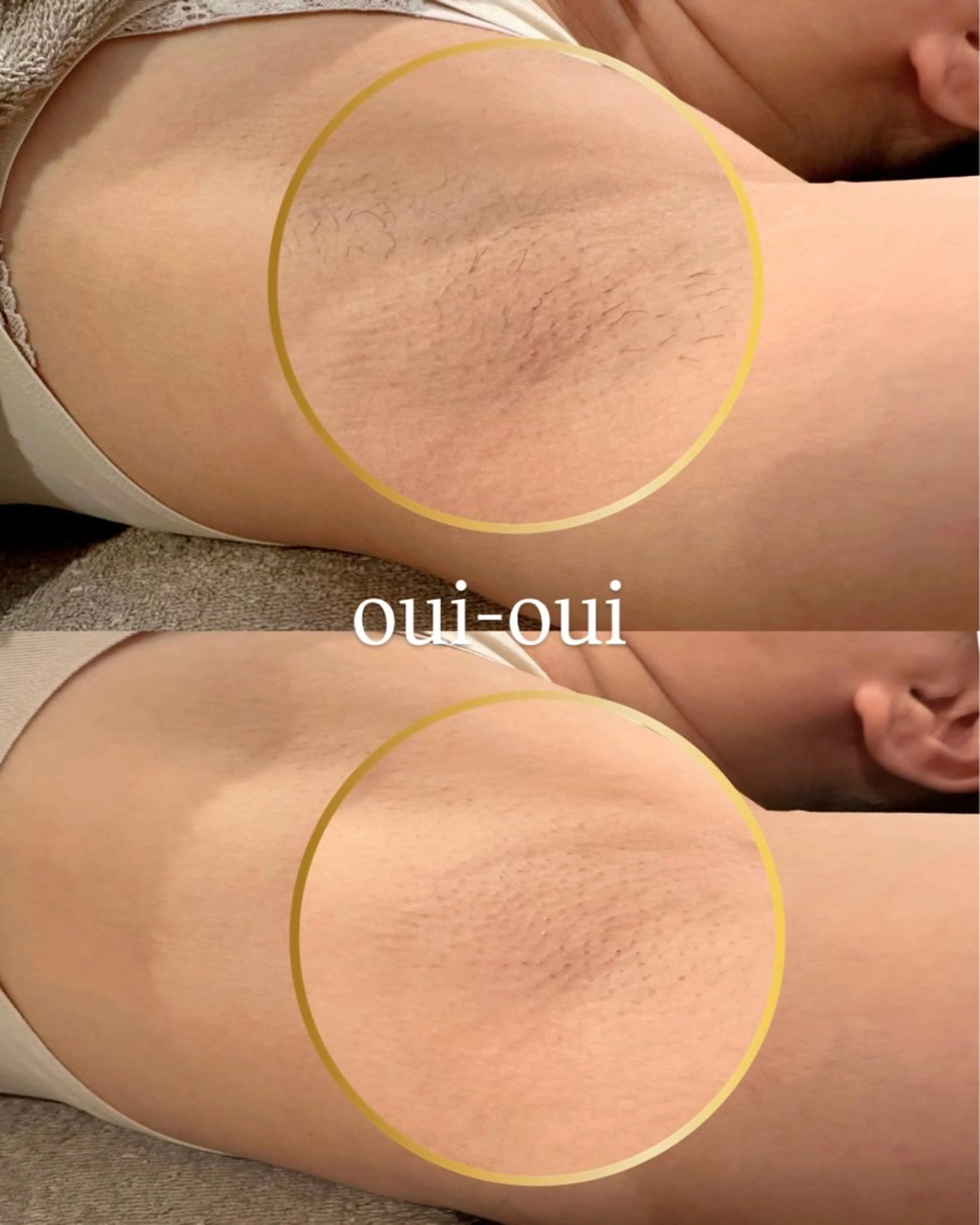 oui-oui　ウィウィ所属・oui-oui 磐田脱毛のエステ・リラクイメージ