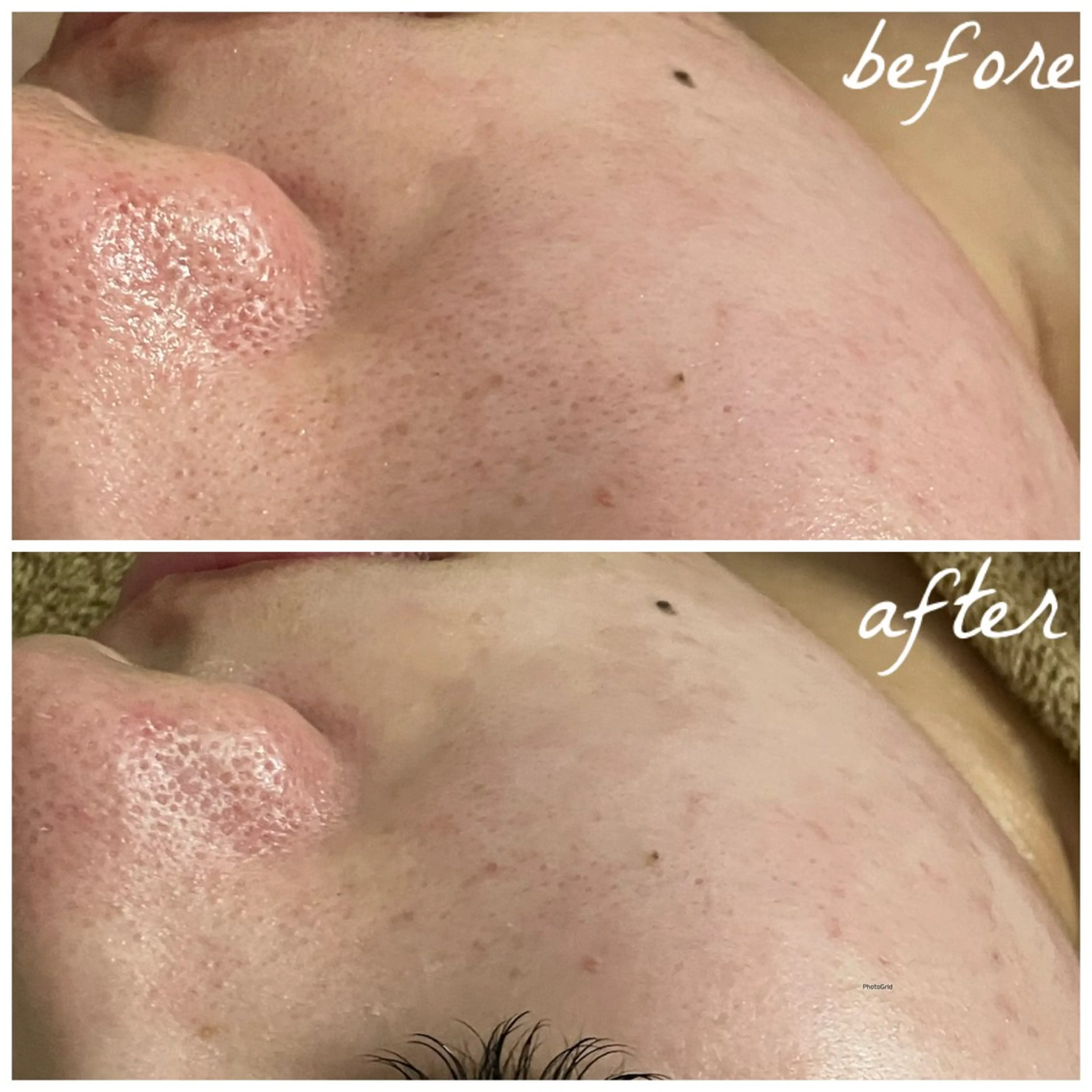 メンズ エステ メナード岐阜茜部 杉浦のエステ・リラクイメージ