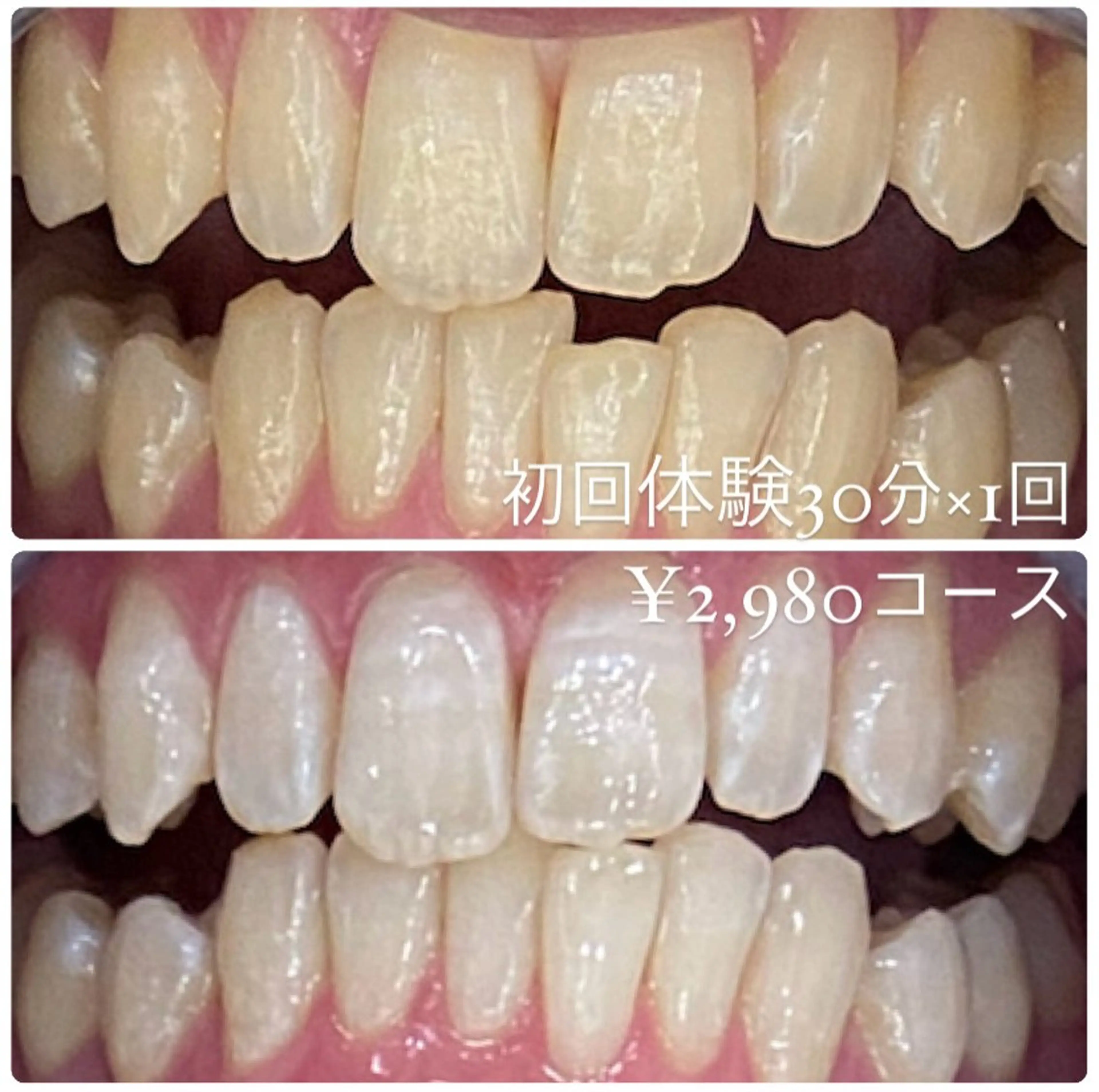 PLATINUM Beauty 横浜店所属・ホワイトニングルーム 横浜店のその他イメージ