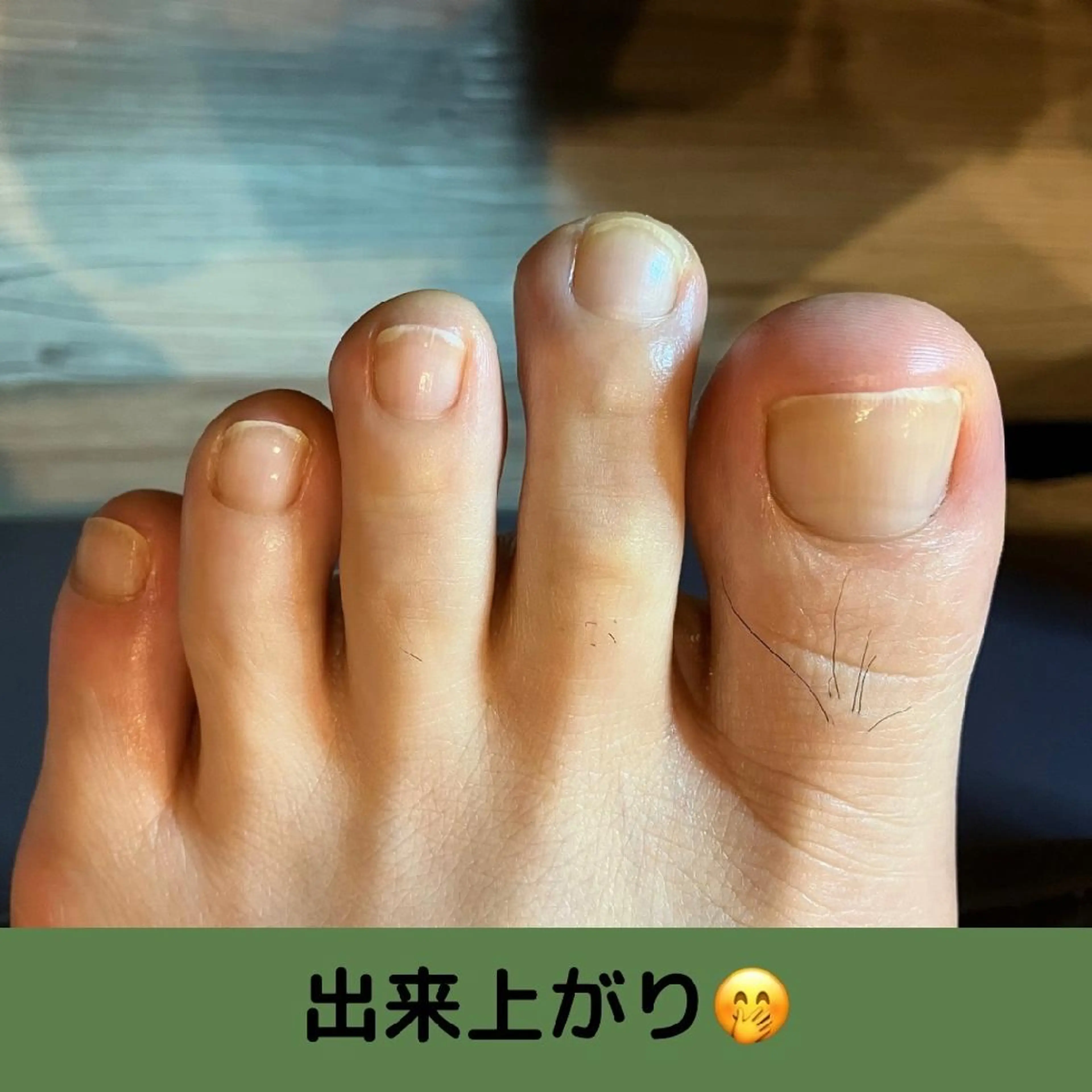 ネイル carenail　 tsugumiのその他イメージ